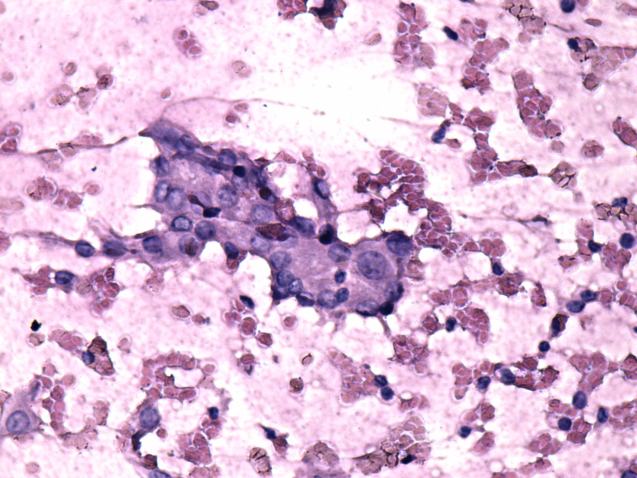 Right lobe, longitudinal scan