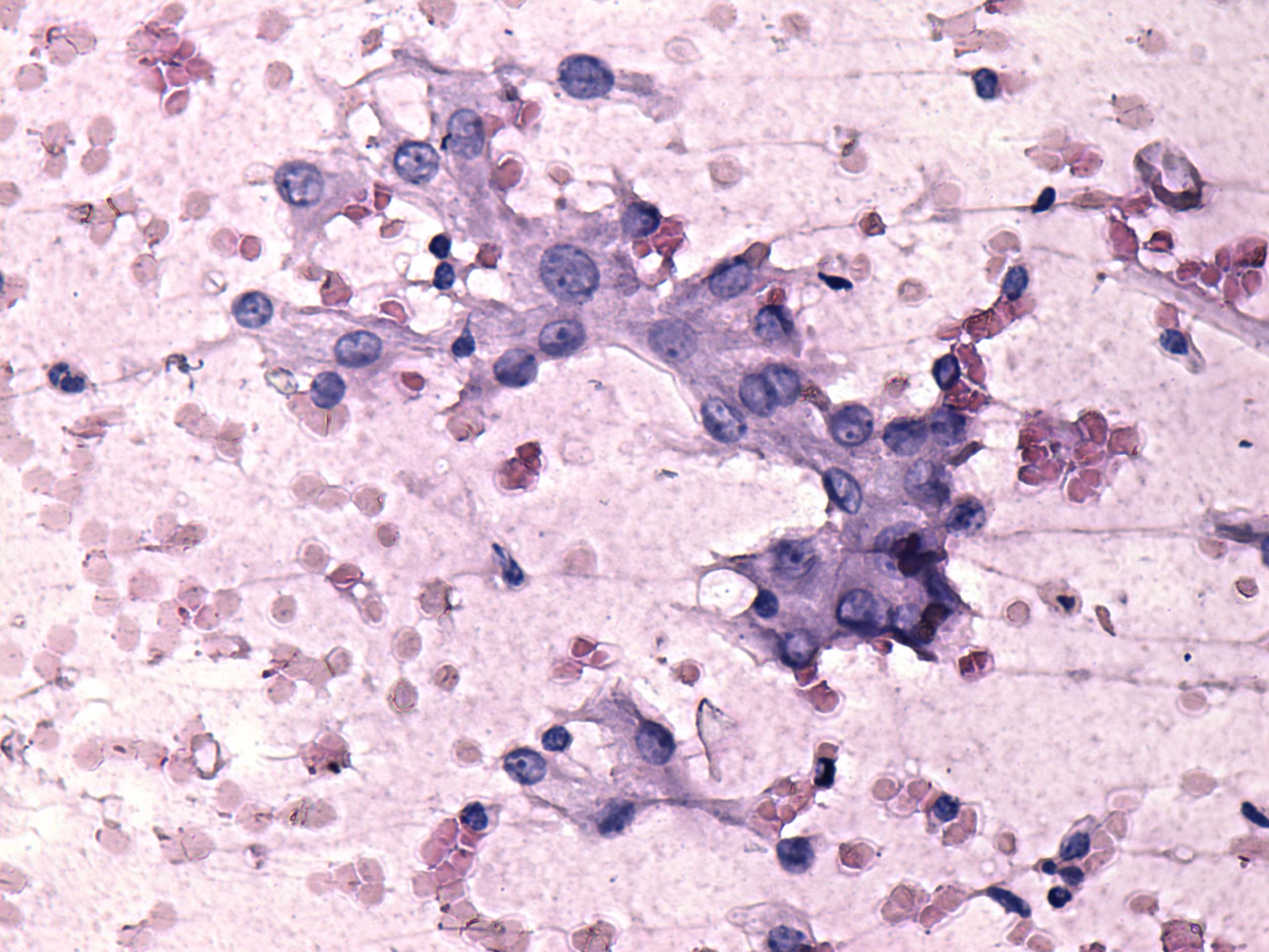 Right lobe, longitudinal scan