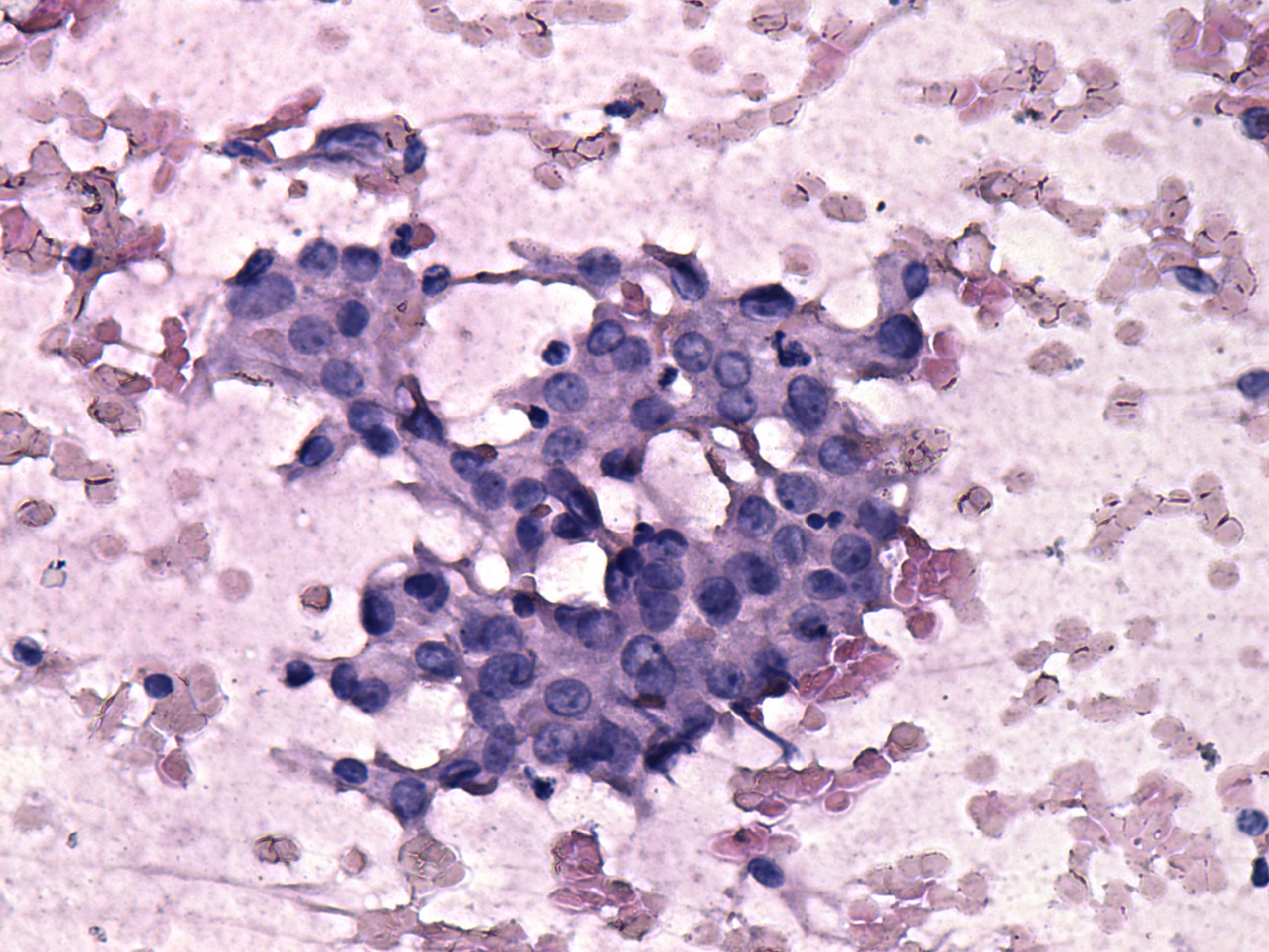 Right lobe, longitudinal scan