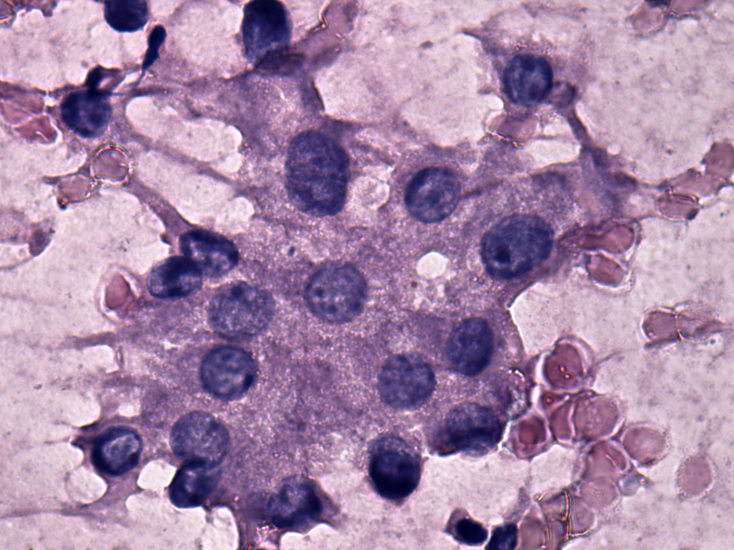 Right lobe, longitudinal scan