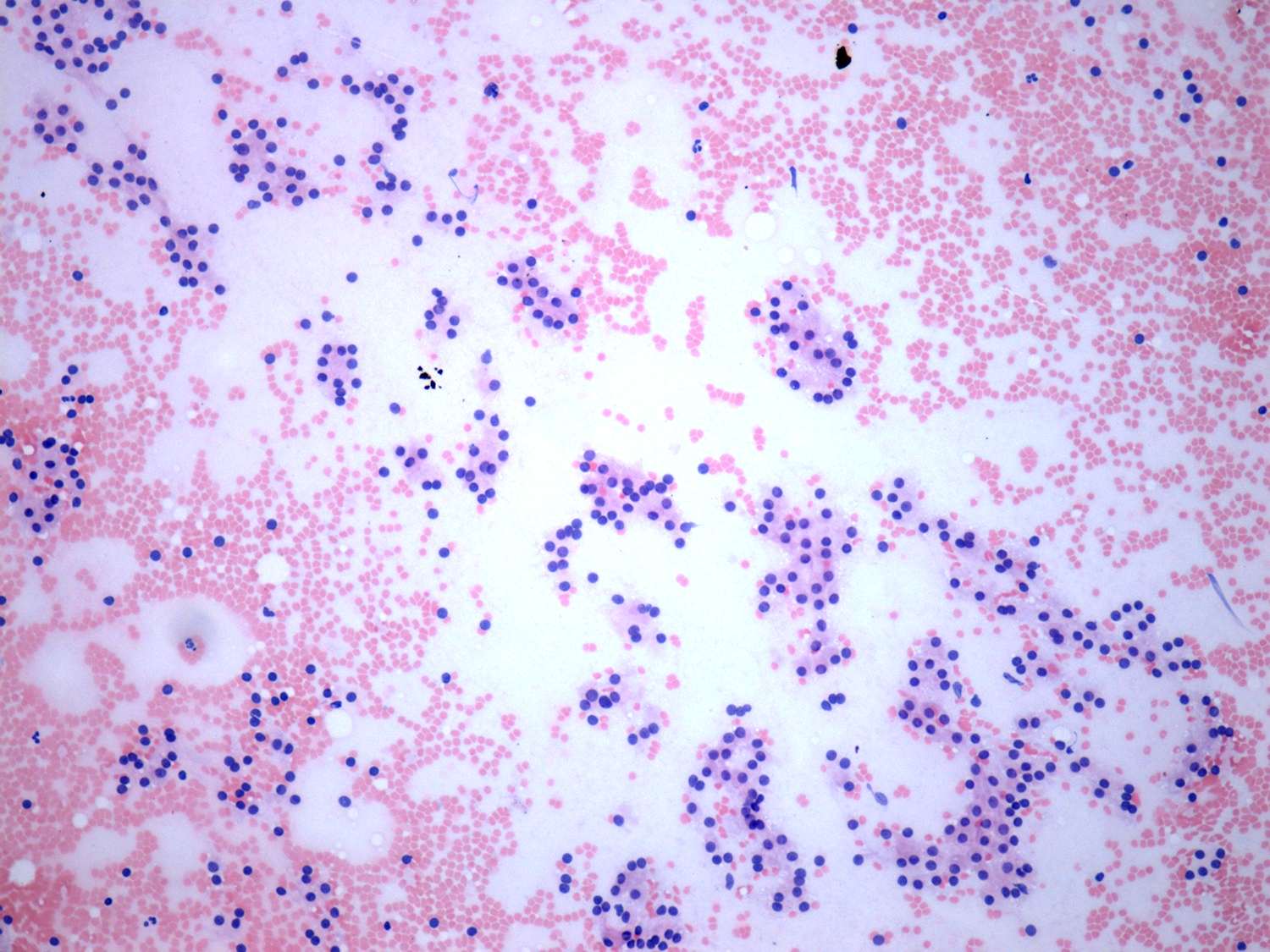 Right lobe, longitudinal scan
