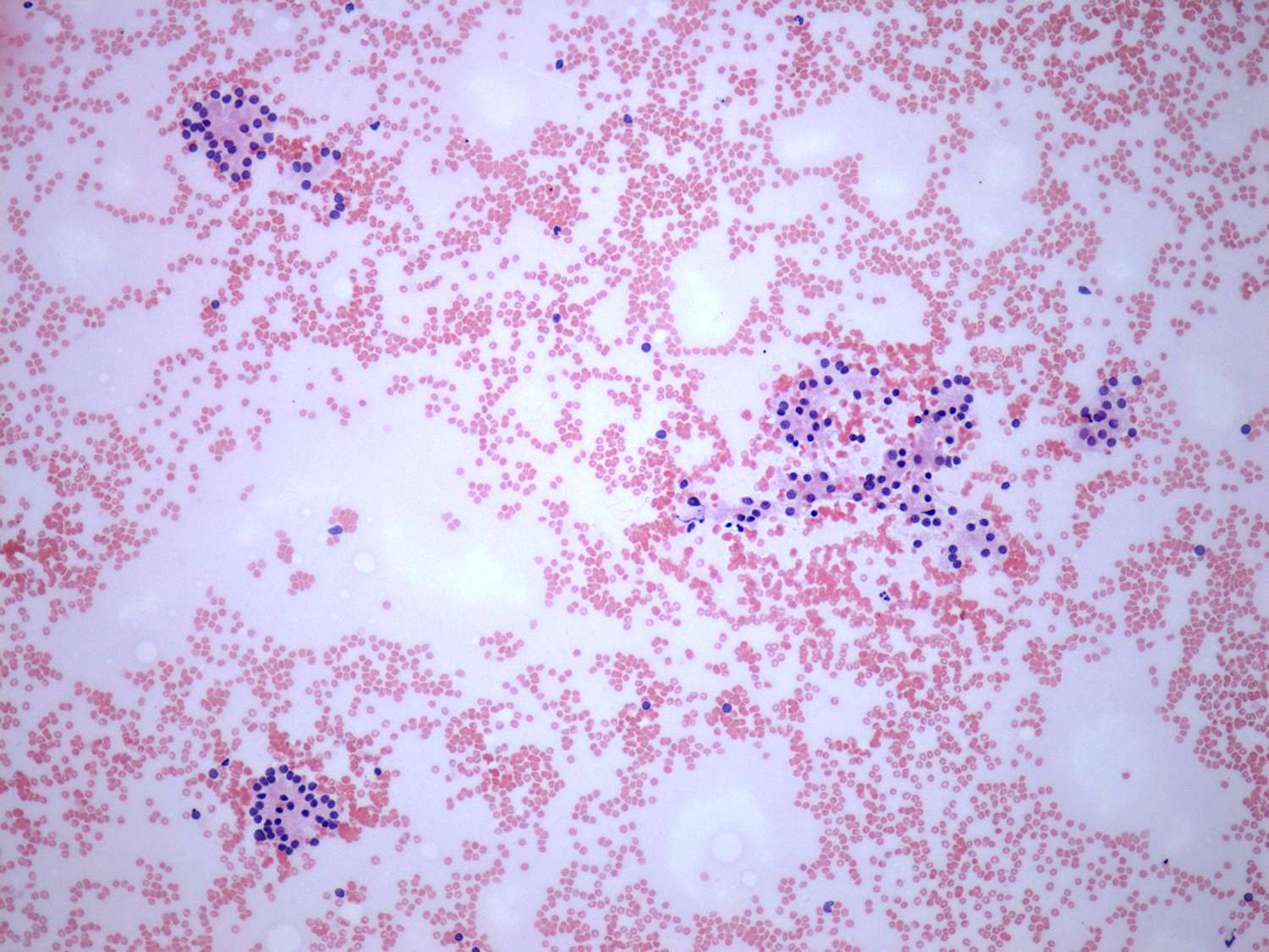 Right lobe, longitudinal scan