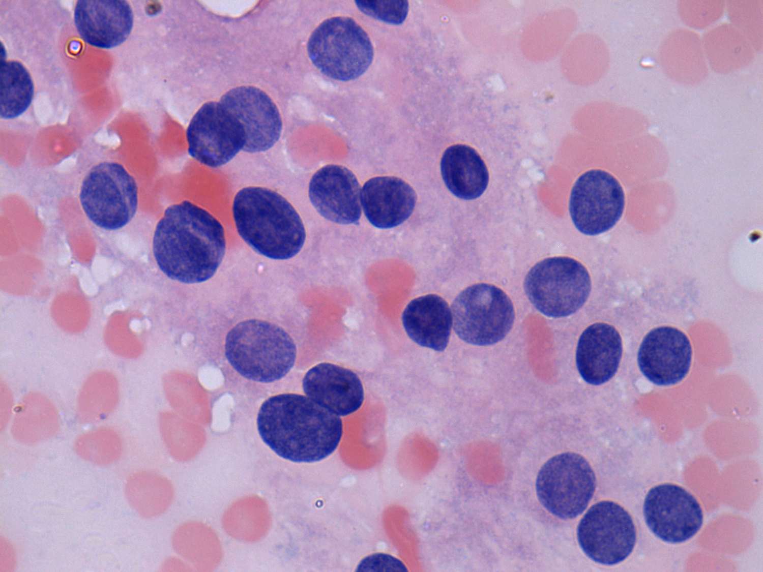 Right lobe, longitudinal scan