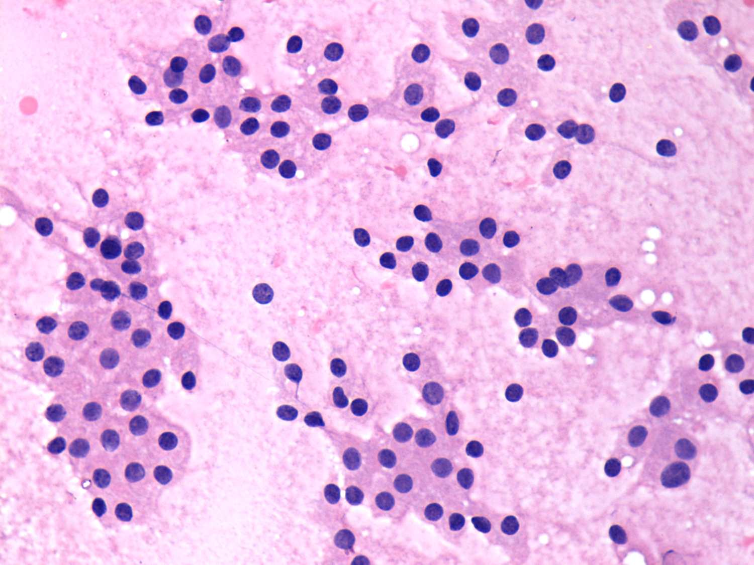 Right lobe, longitudinal scan