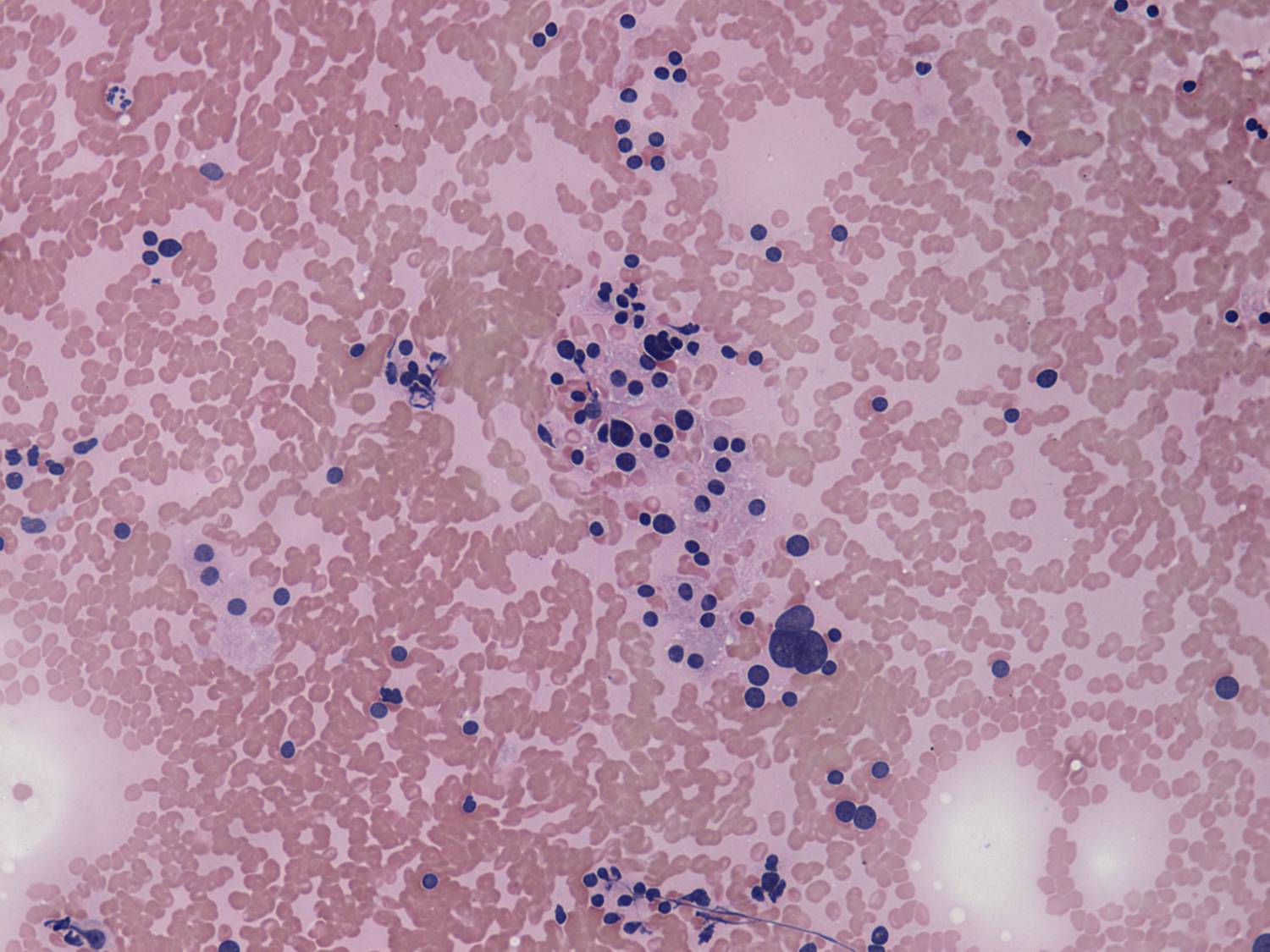 Right lobe, longitudinal scan