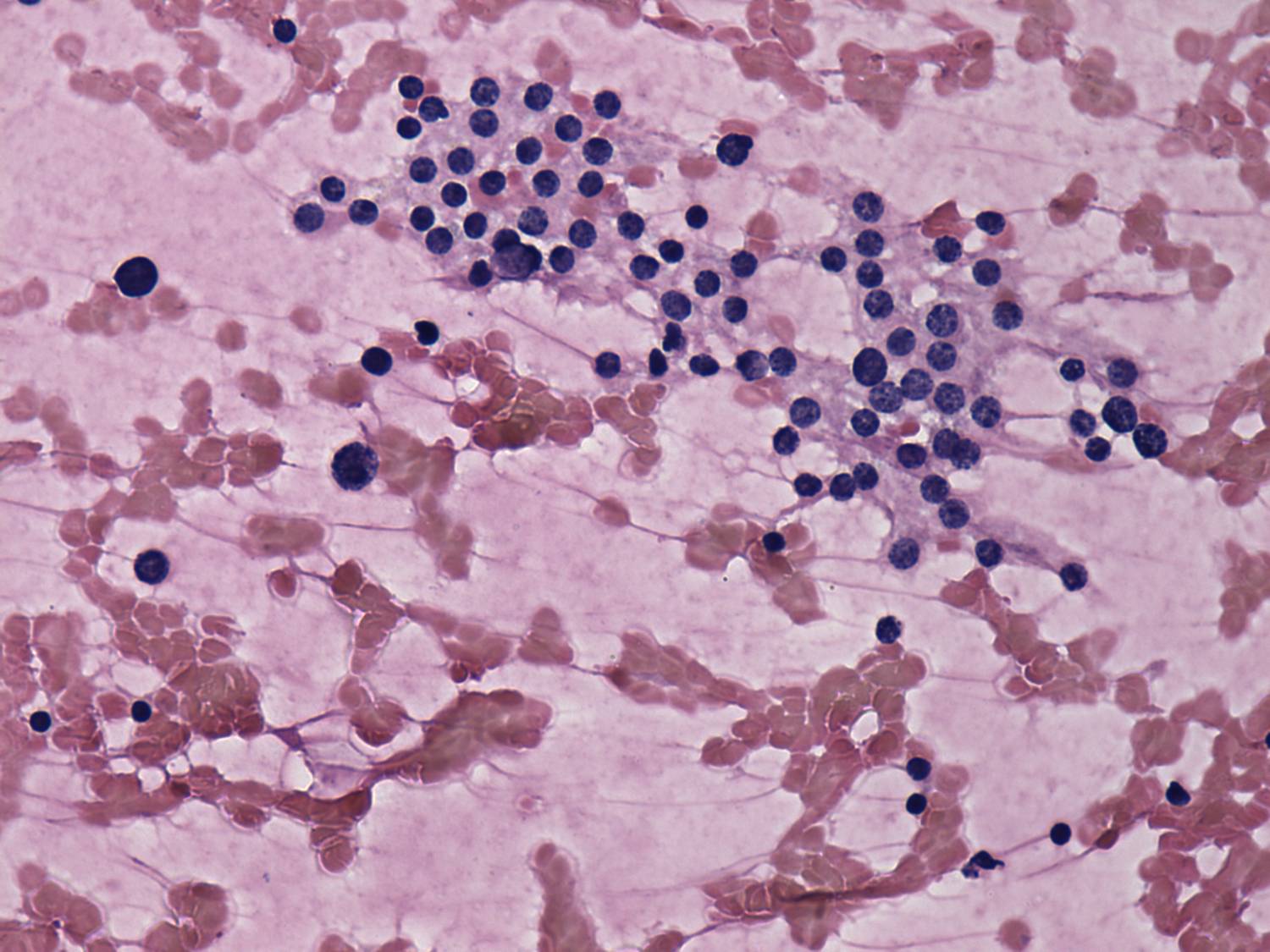 Right lobe, longitudinal scan