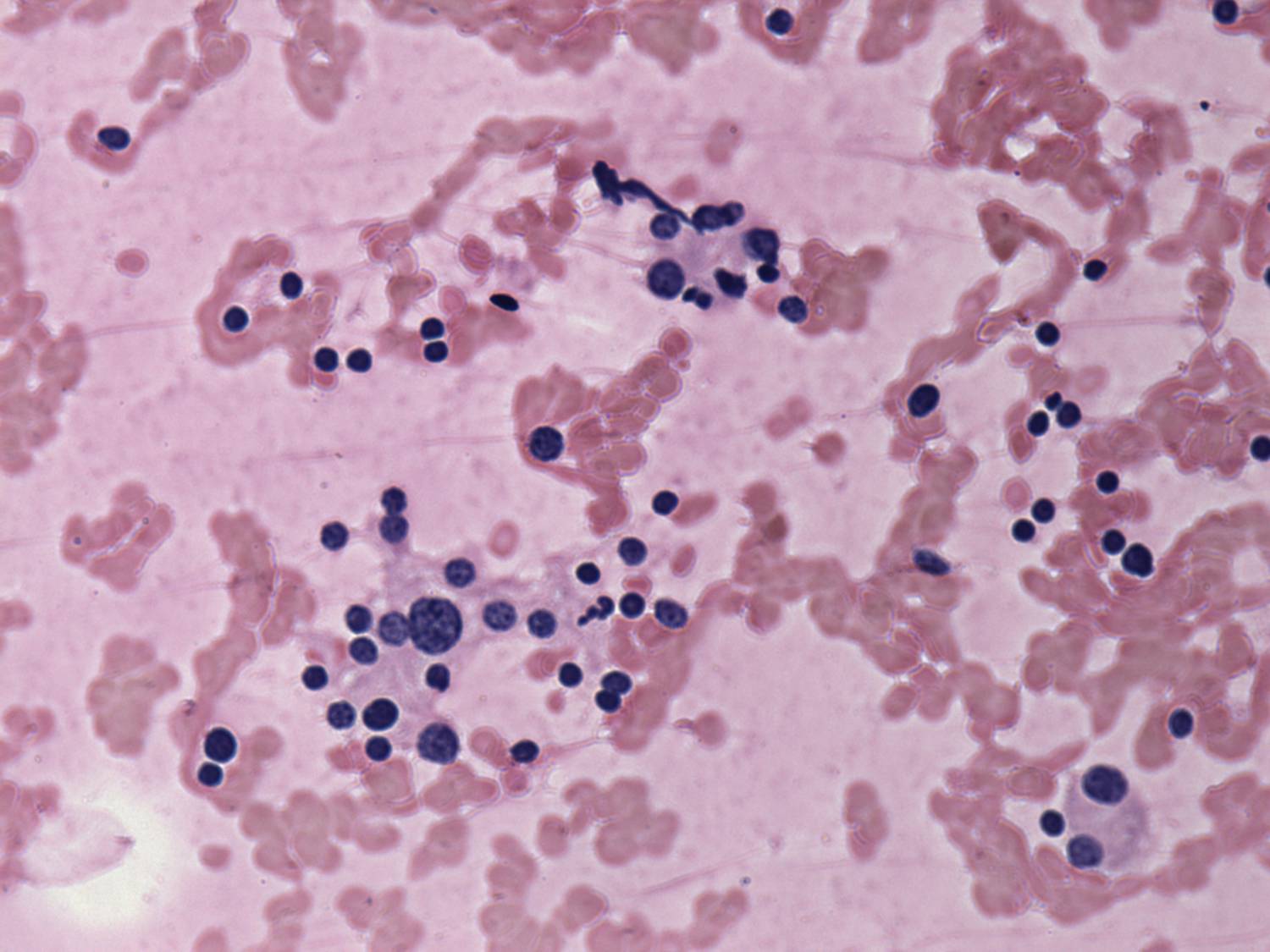 Right lobe, longitudinal scan