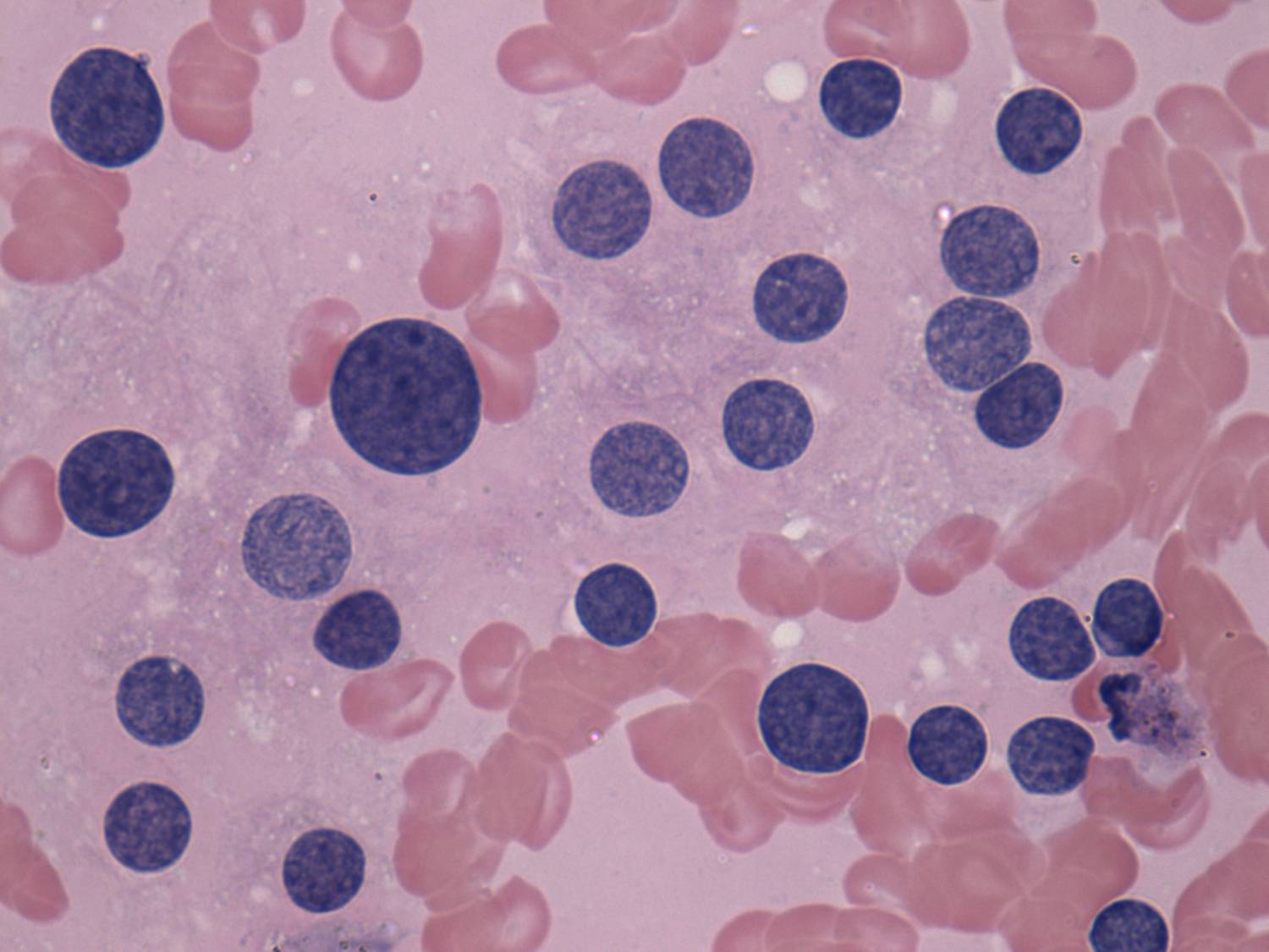 Right lobe, longitudinal scan