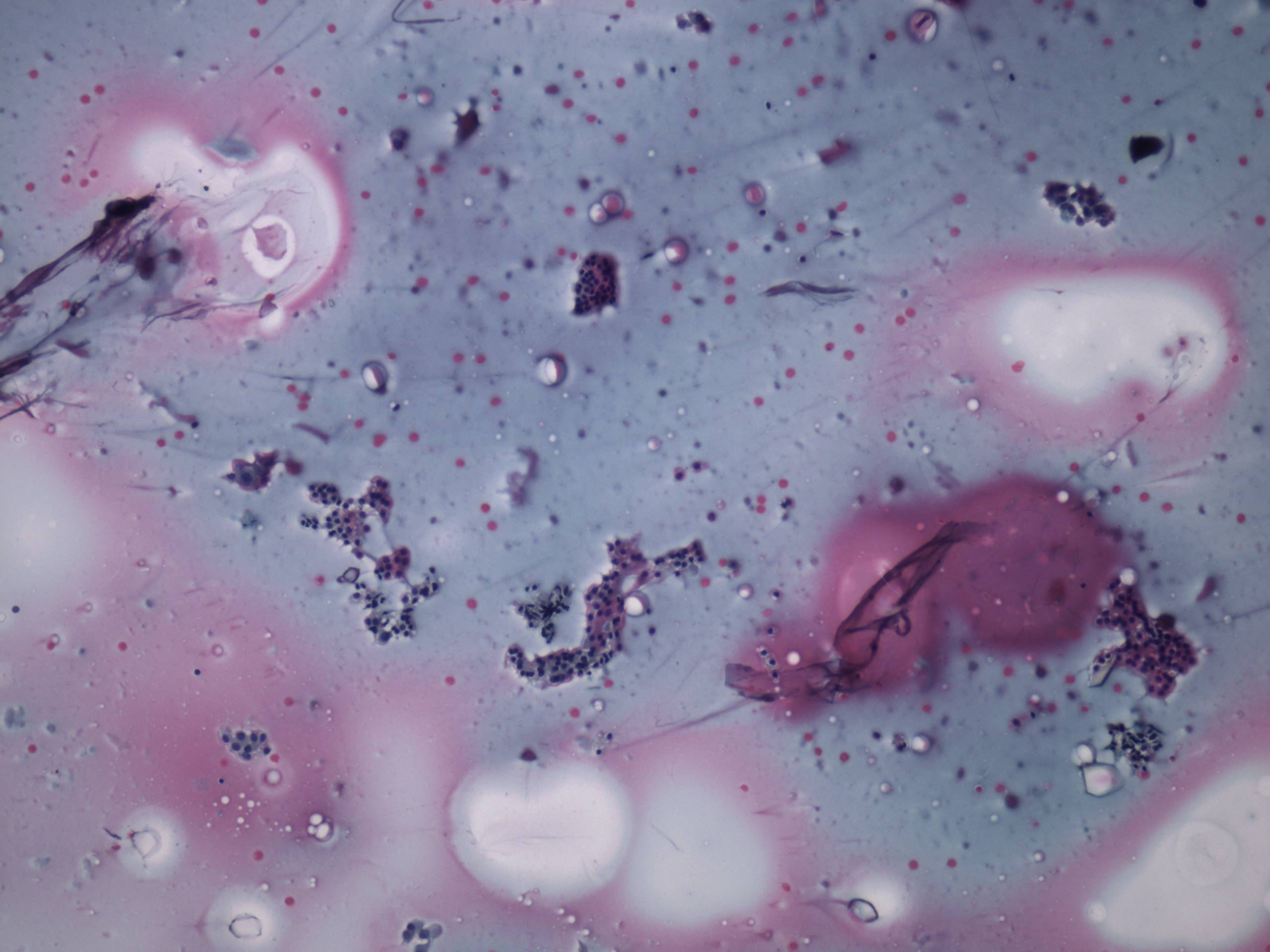 Right lobe, longitudinal scan