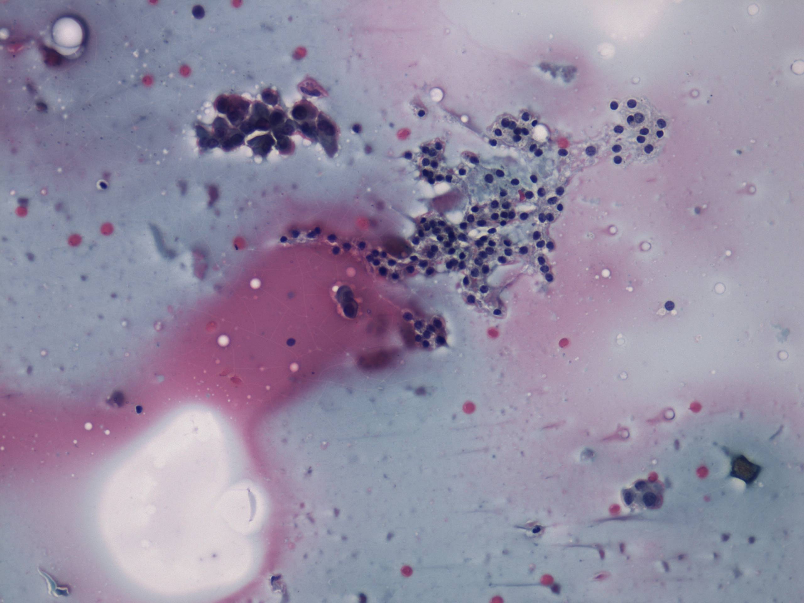 Right lobe, longitudinal scan