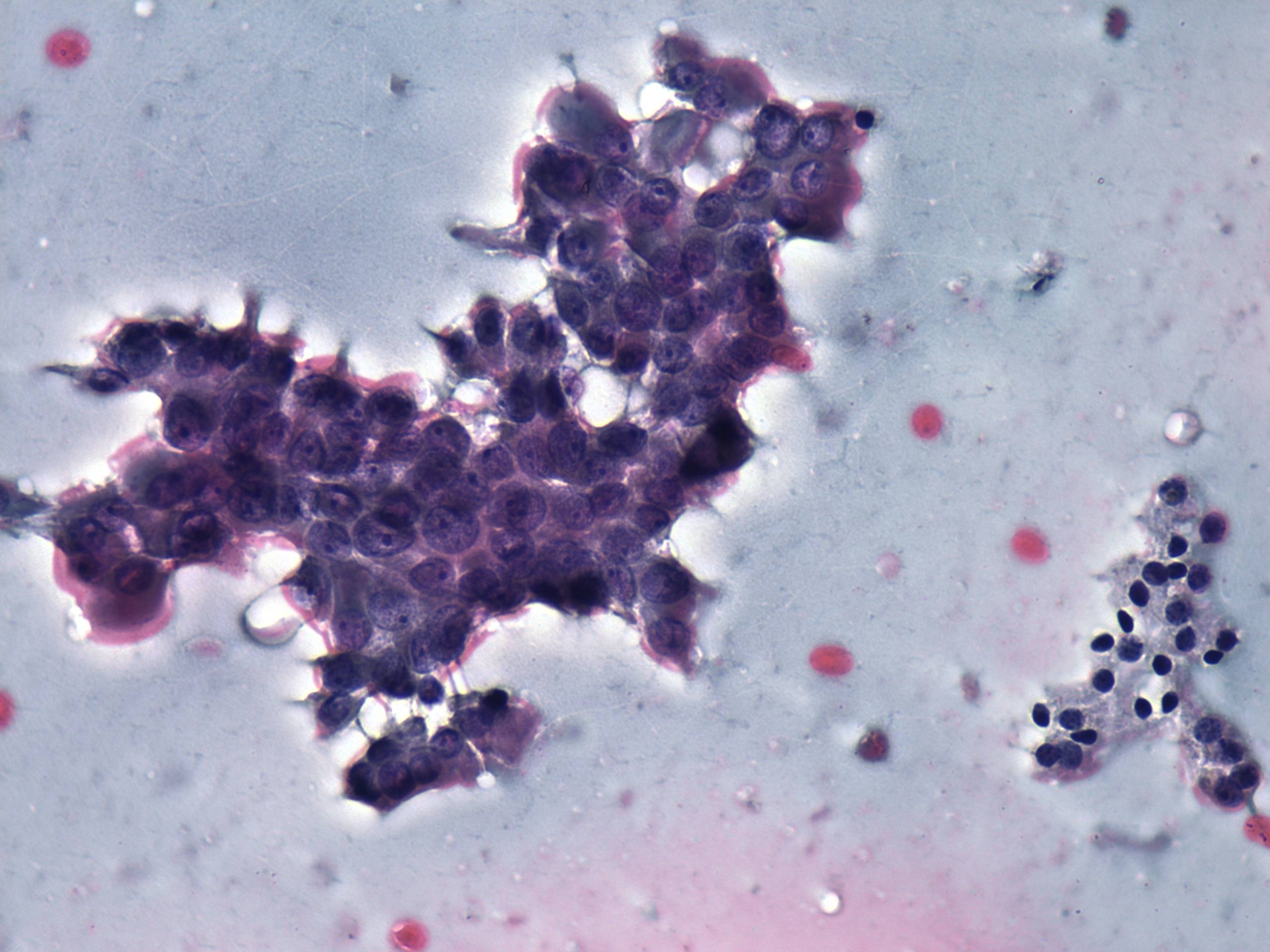 Right lobe, longitudinal scan