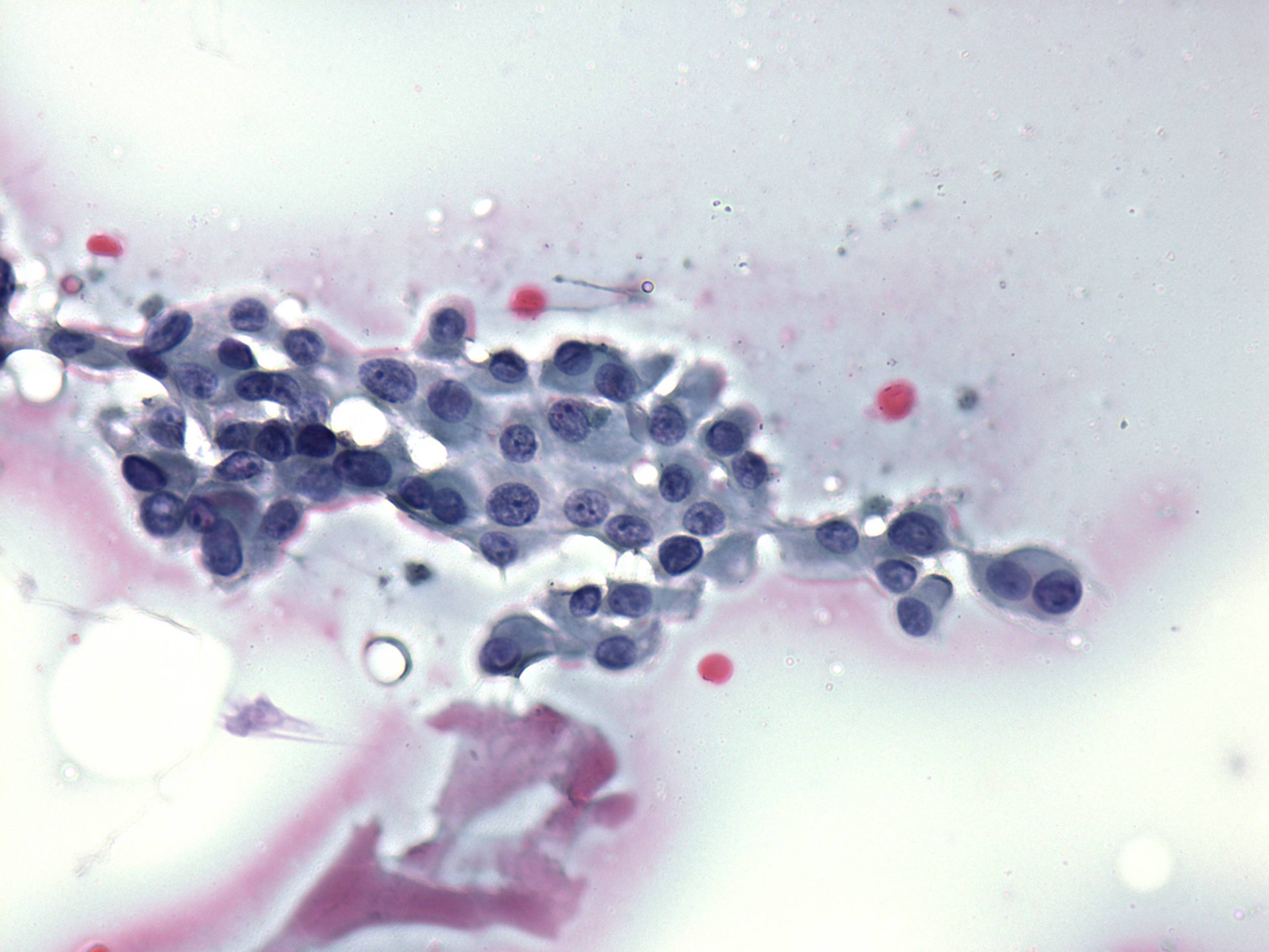 Right lobe, longitudinal scan