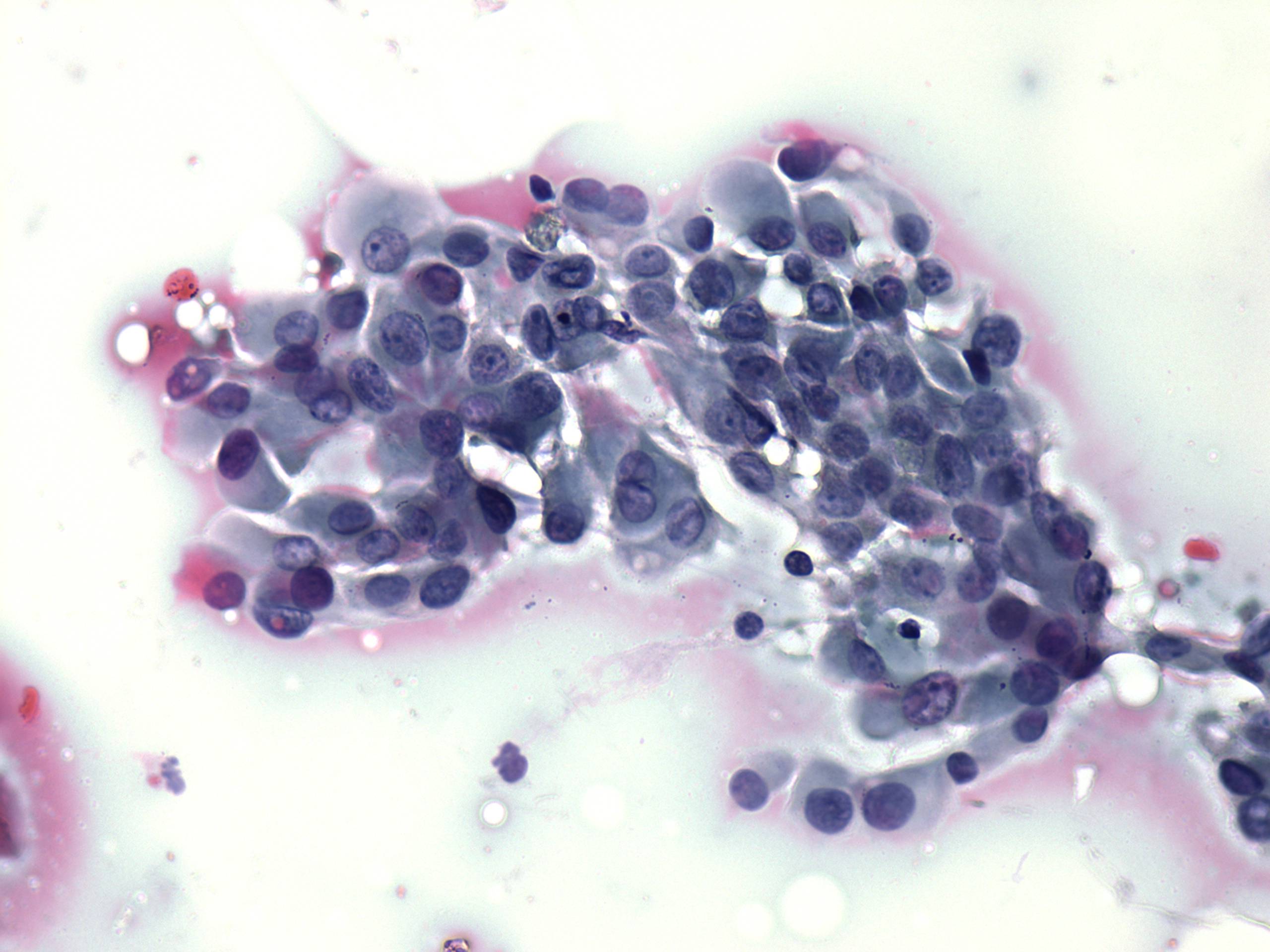 Right lobe, longitudinal scan
