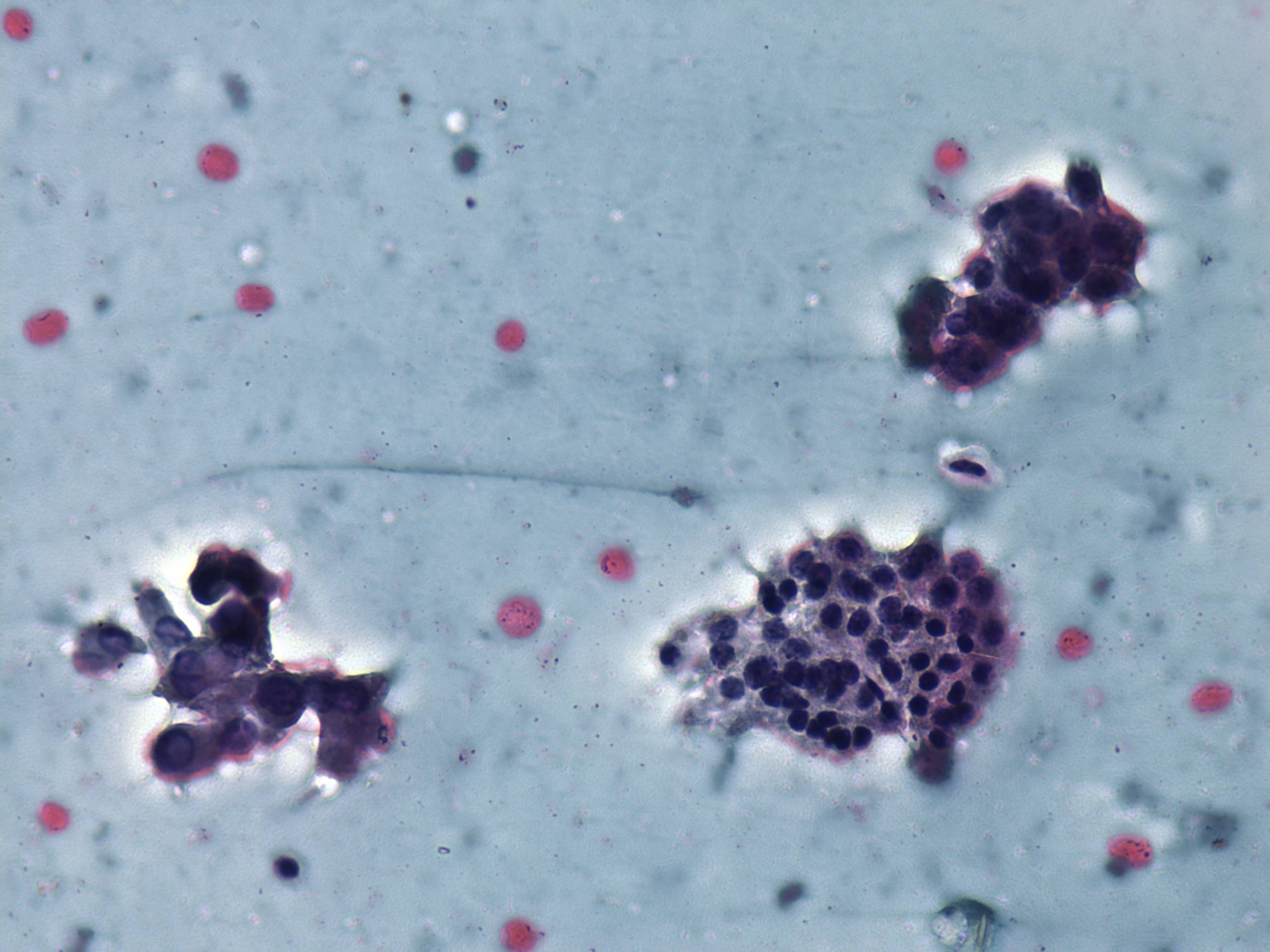 Right lobe, longitudinal scan