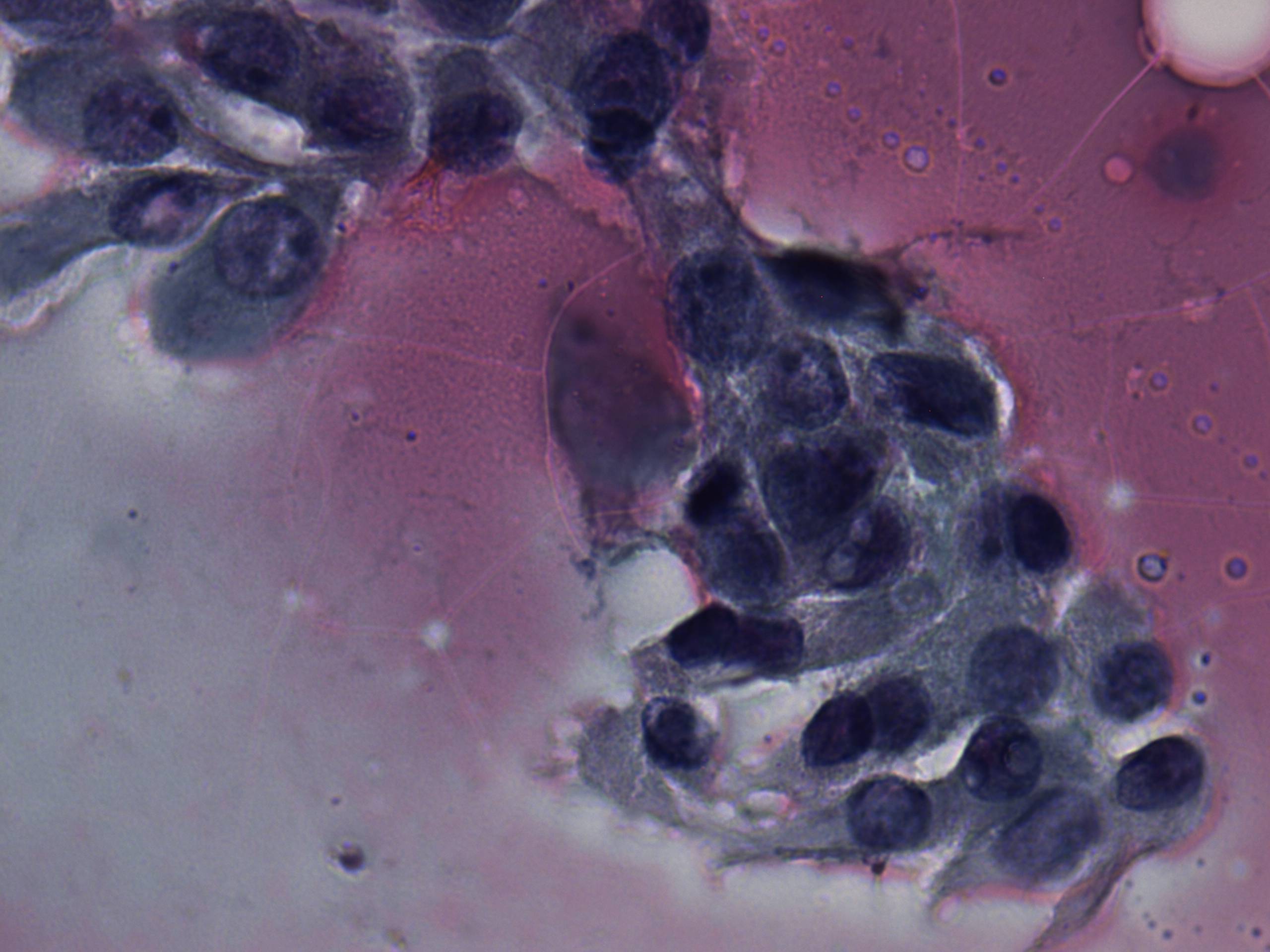 Right lobe, longitudinal scan