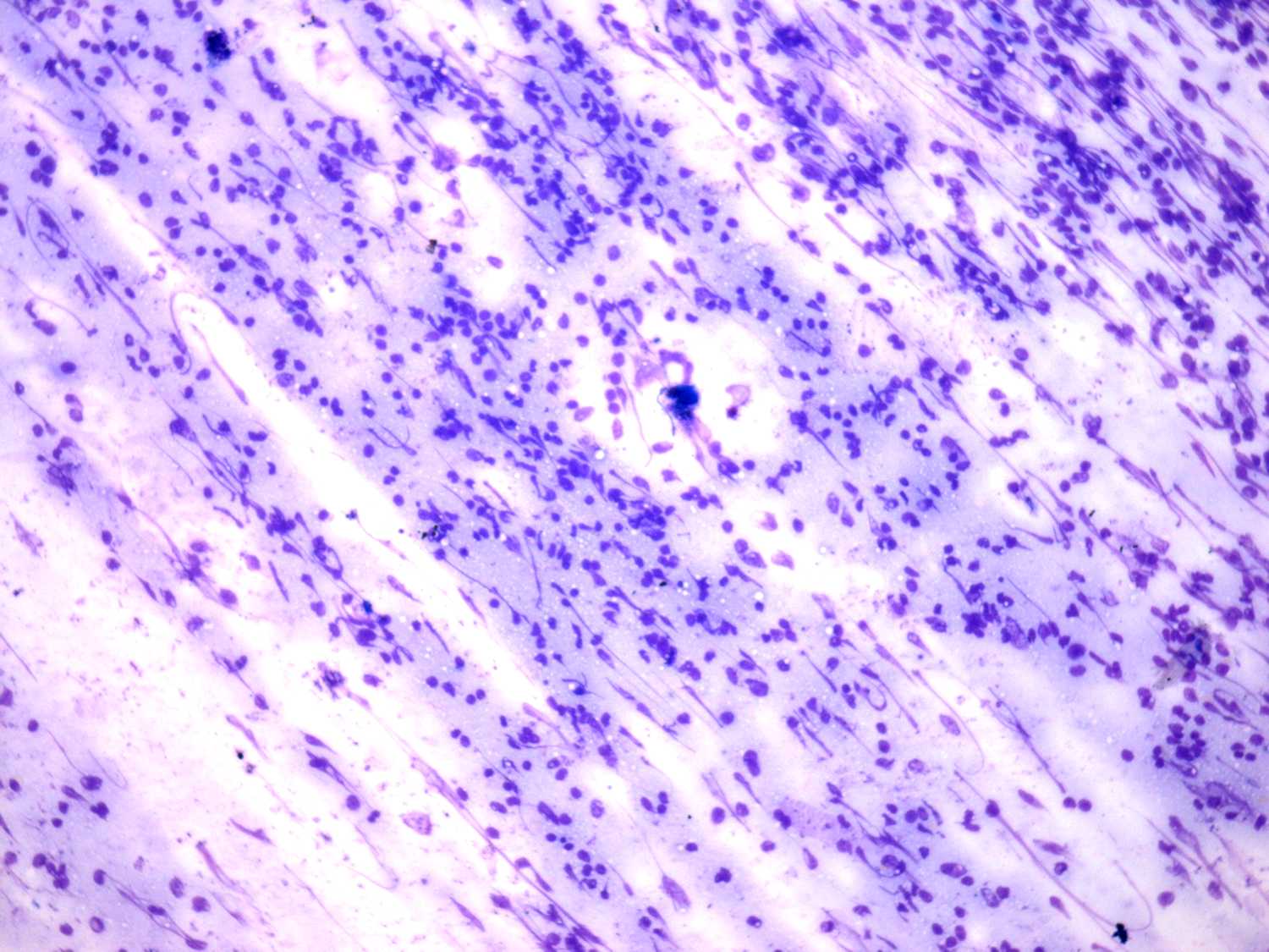 Right lobe, longitudinal scan