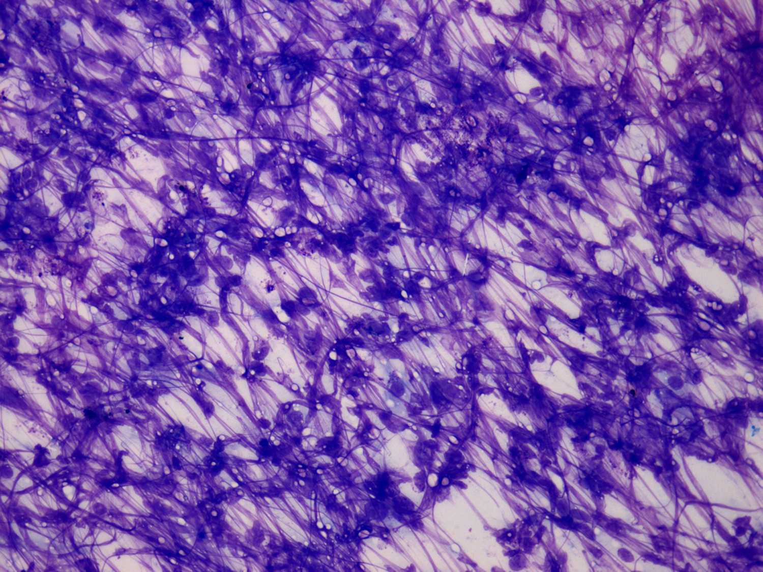Right lobe, longitudinal scan