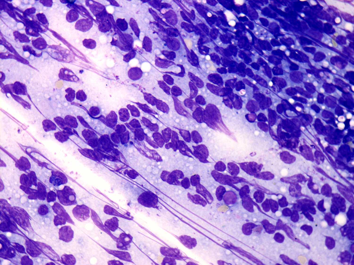 Right lobe, longitudinal scan