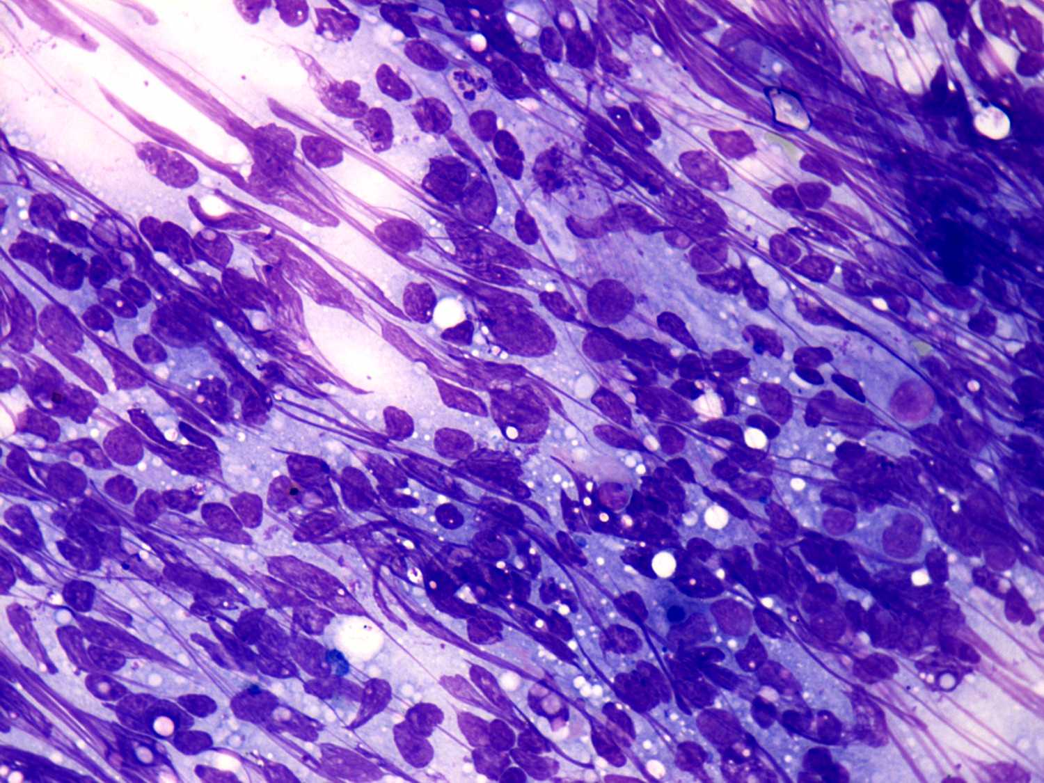Right lobe, longitudinal scan