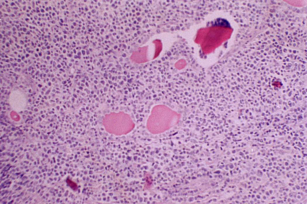 Right lobe, longitudinal scan