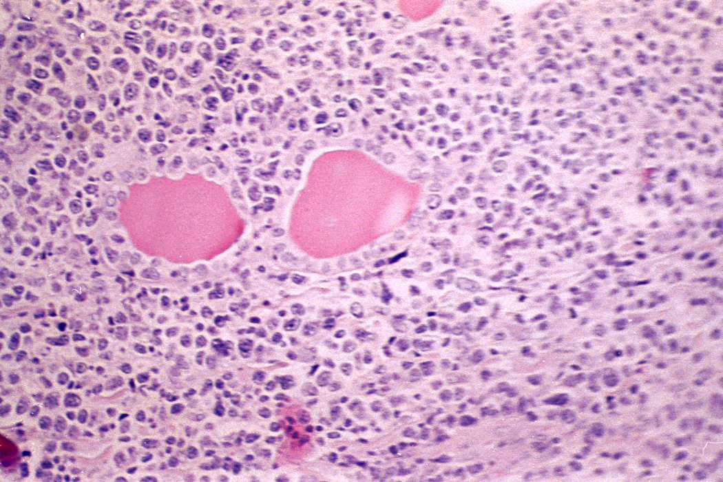 Right lobe, longitudinal scan
