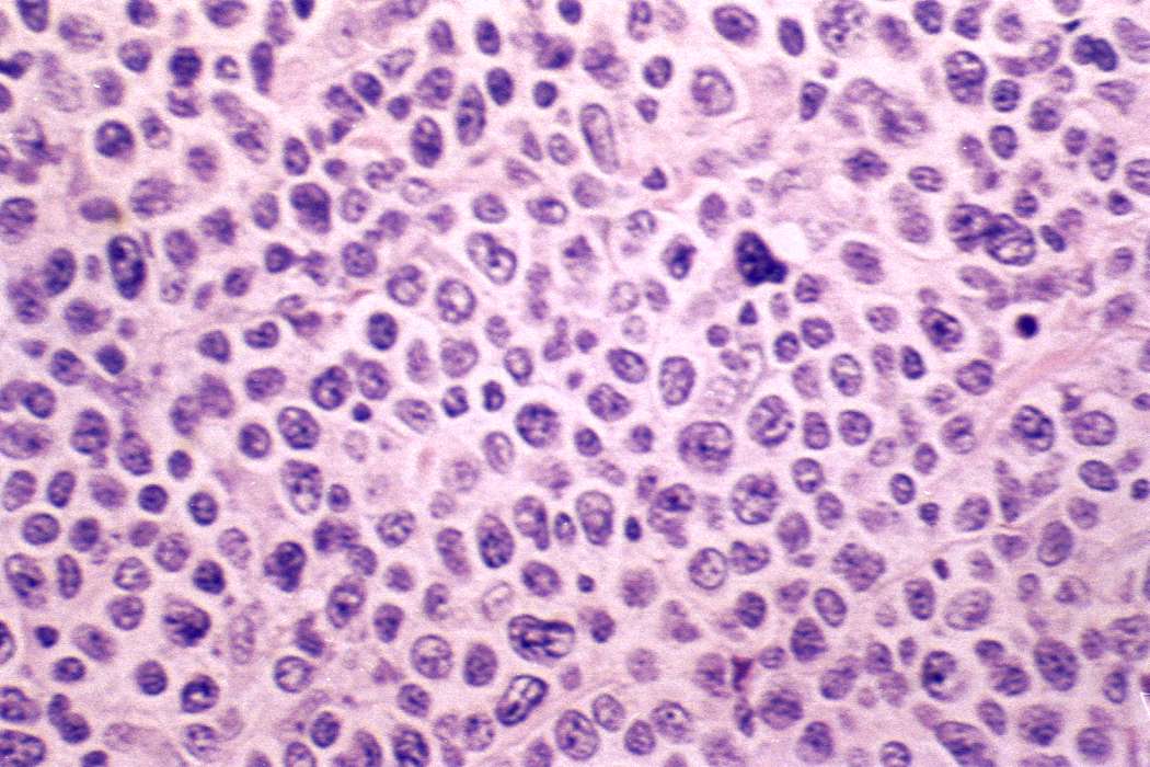 Right lobe, longitudinal scan