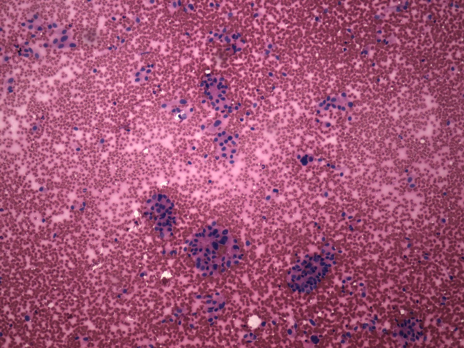 Right lobe, longitudinal scan