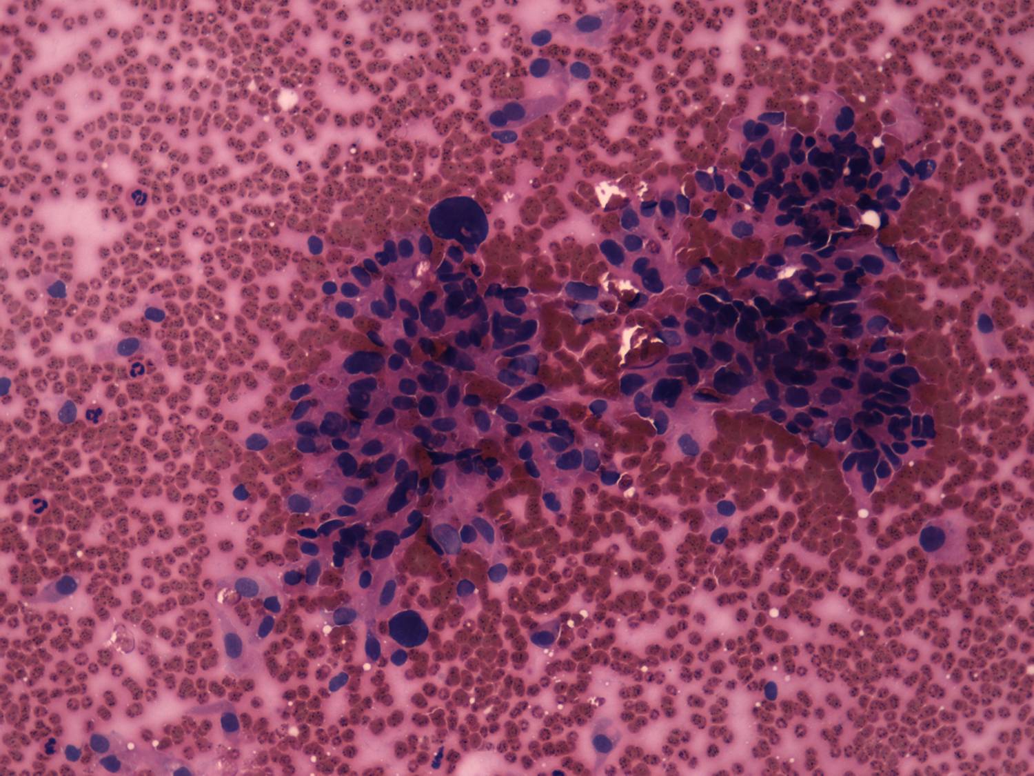 Right lobe, longitudinal scan