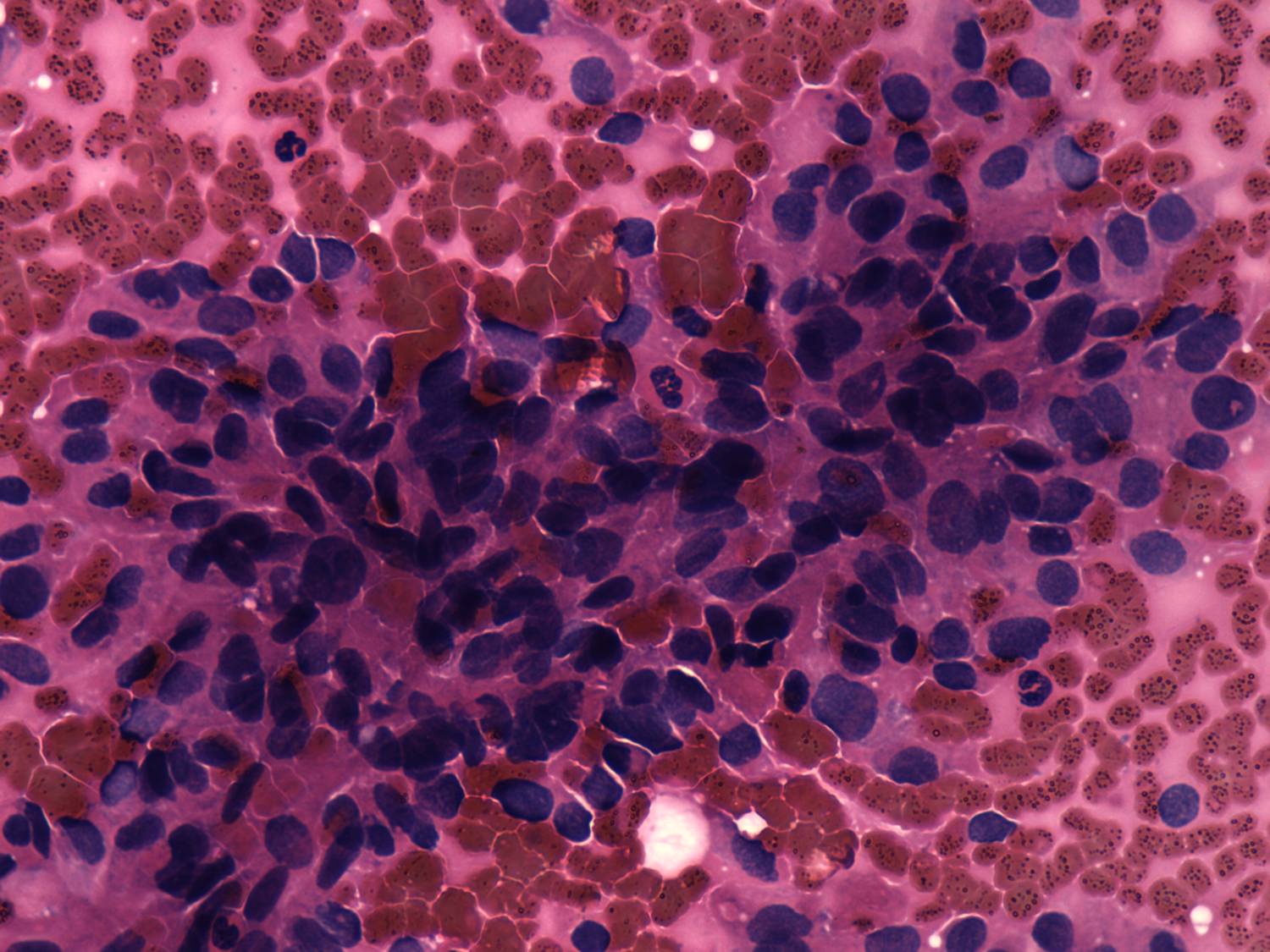 Right lobe, longitudinal scan
