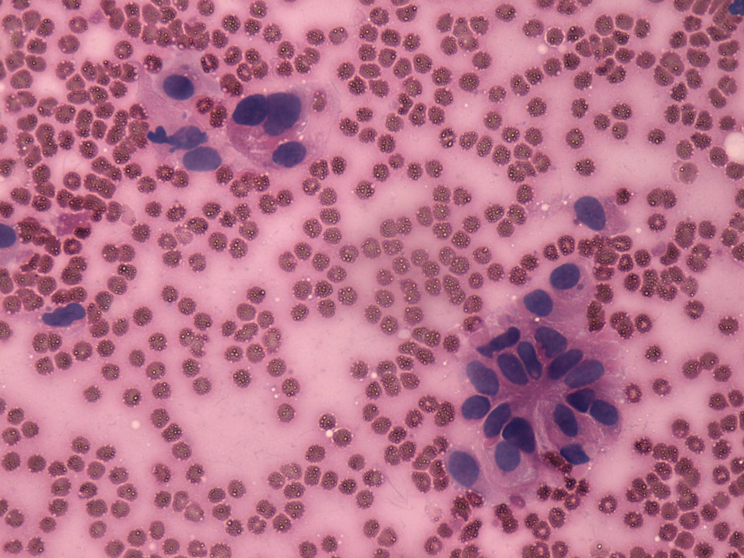 Right lobe, longitudinal scan