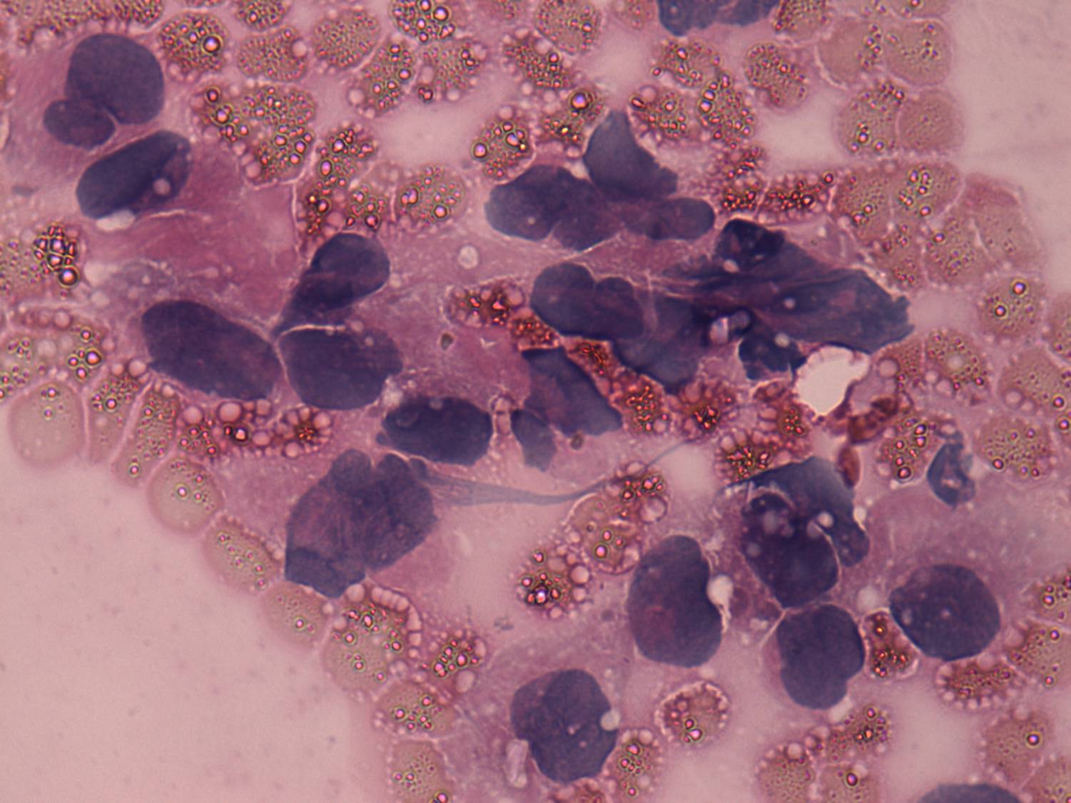 Right lobe, longitudinal scan
