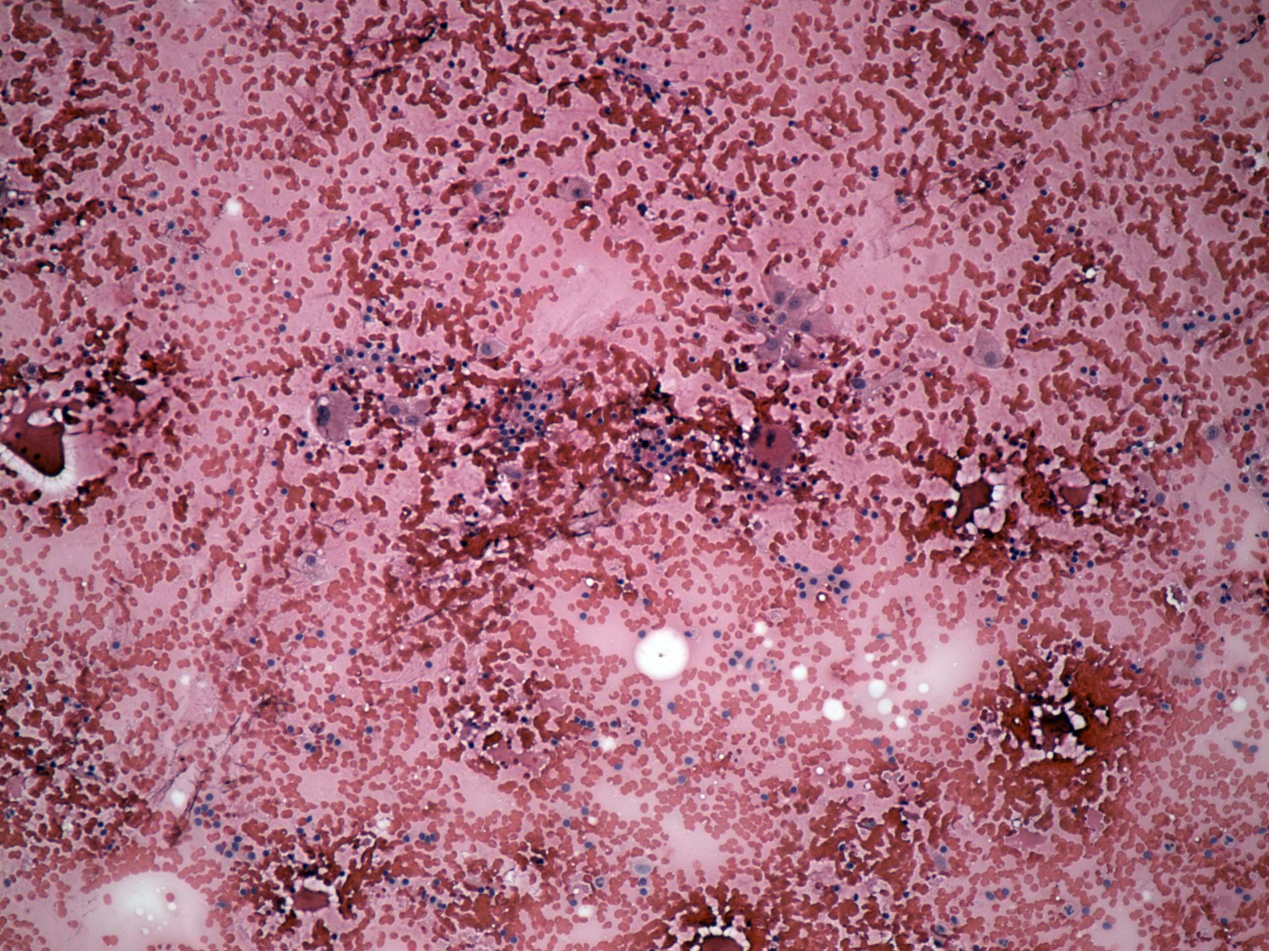 Right lobe, longitudinal scan