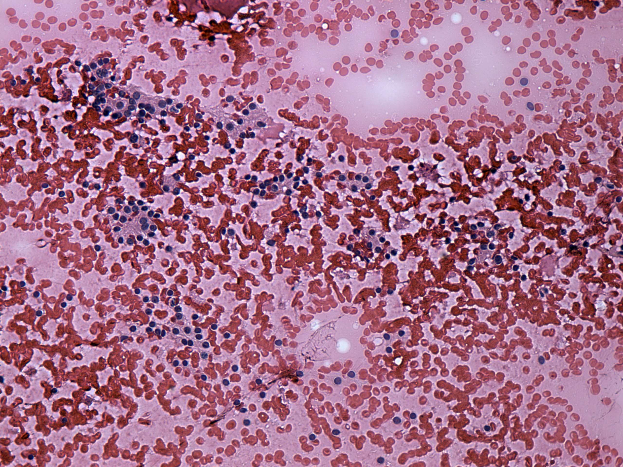 Right lobe, longitudinal scan