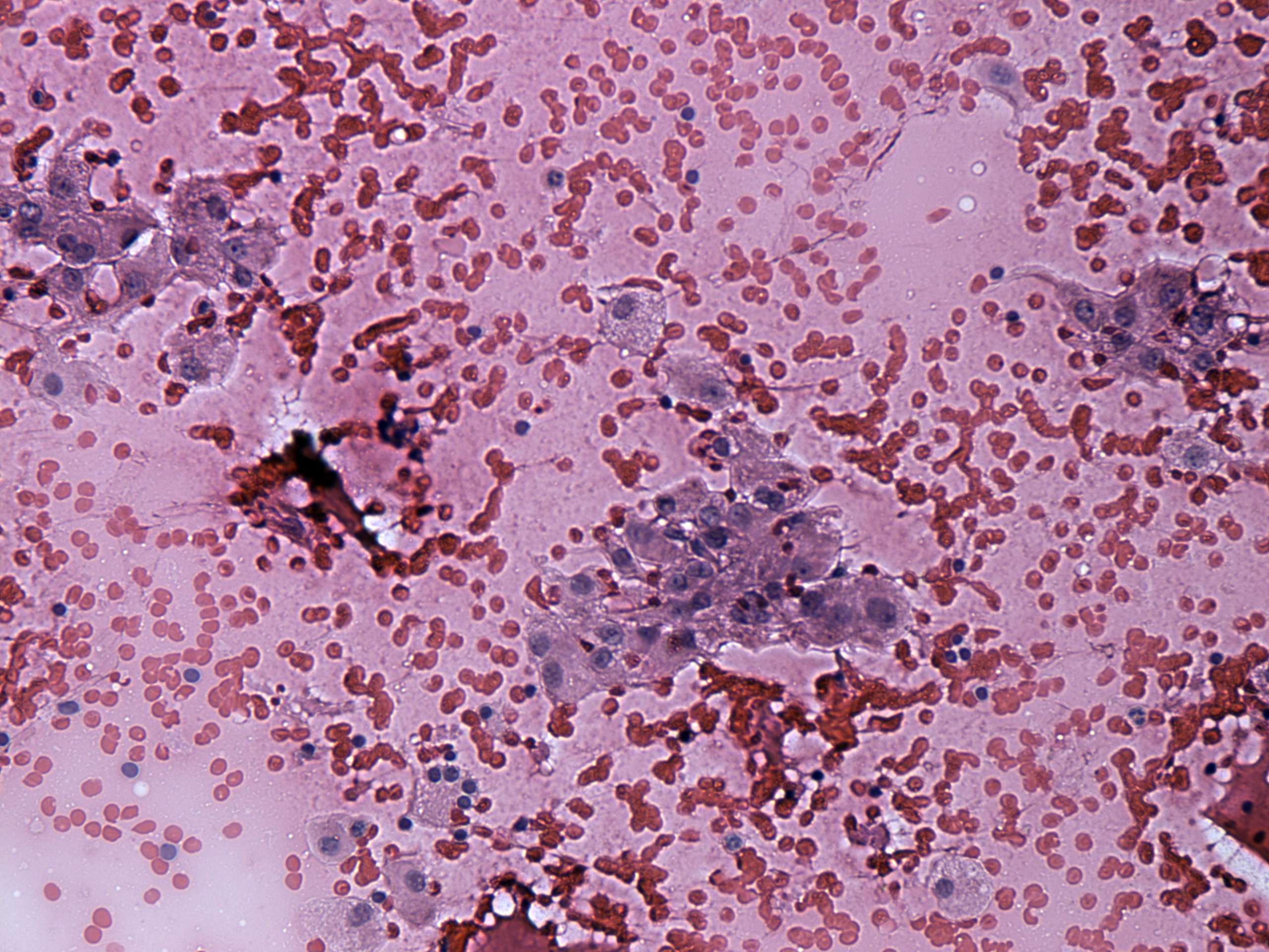 Right lobe, longitudinal scan