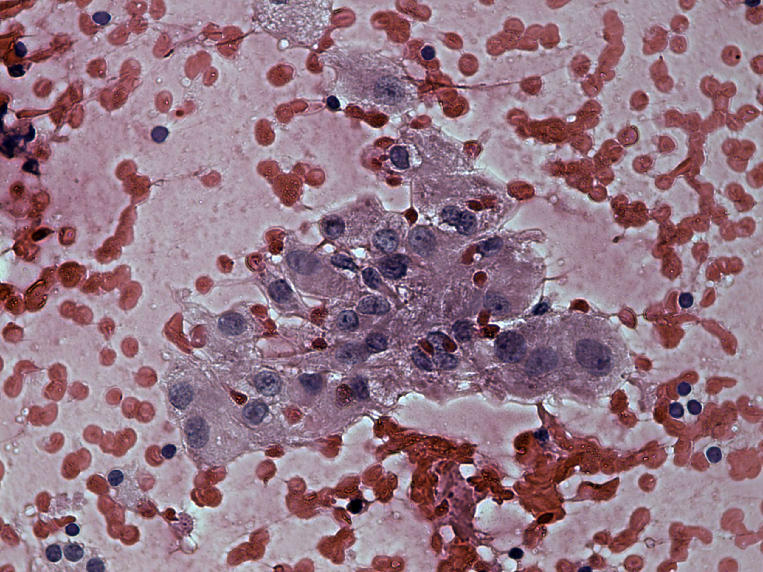 Right lobe, longitudinal scan