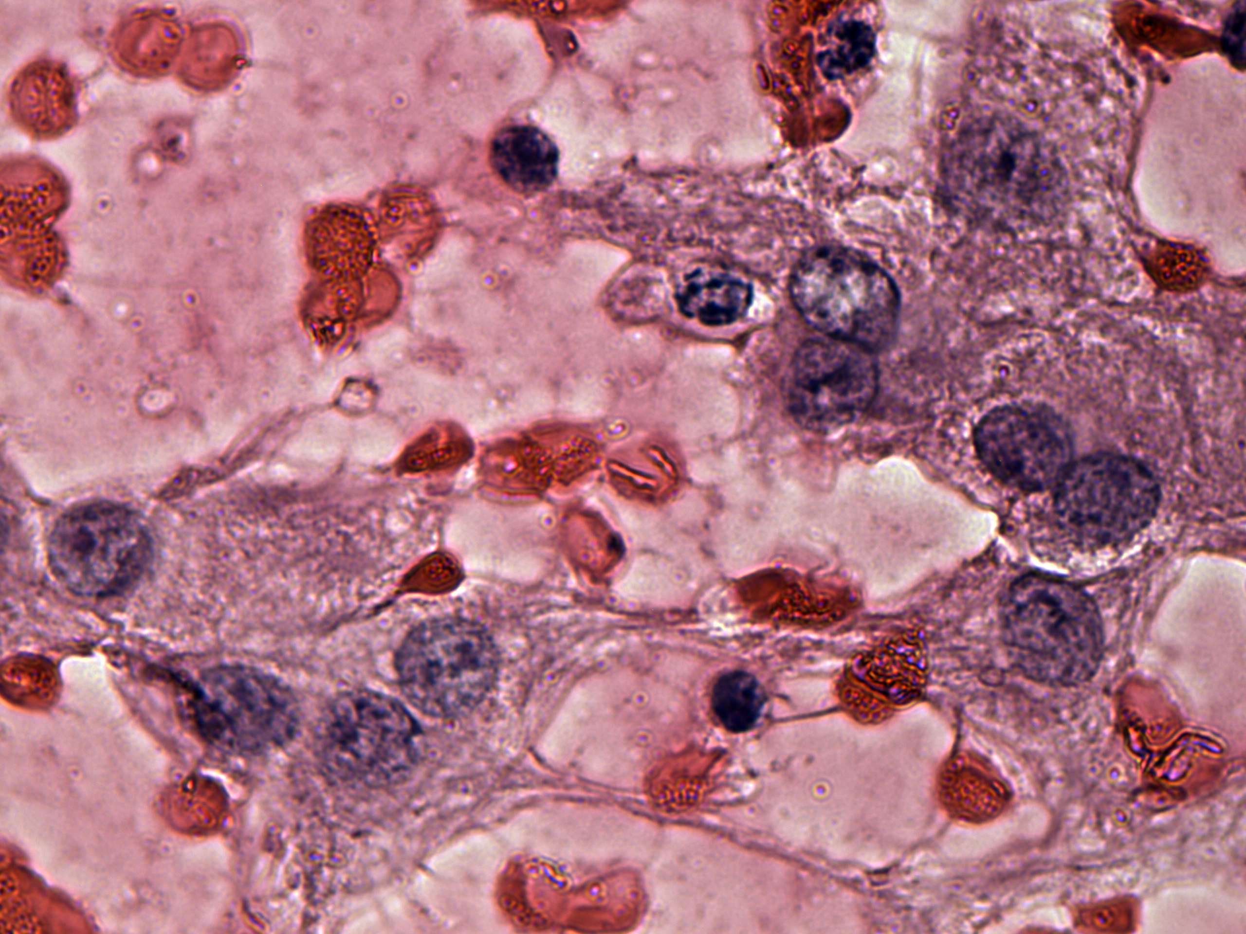 Right lobe, longitudinal scan