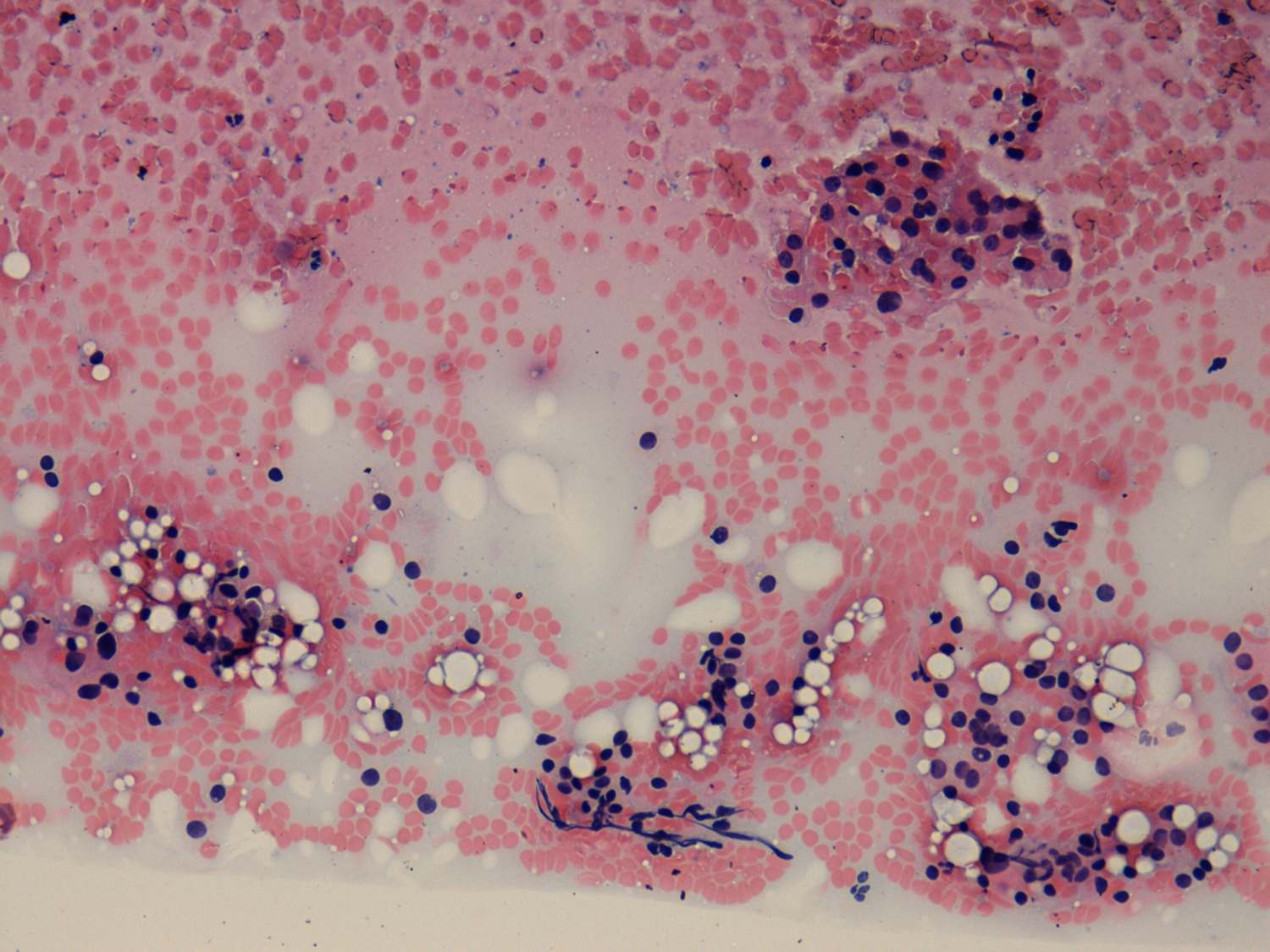 Right lobe, longitudinal scan