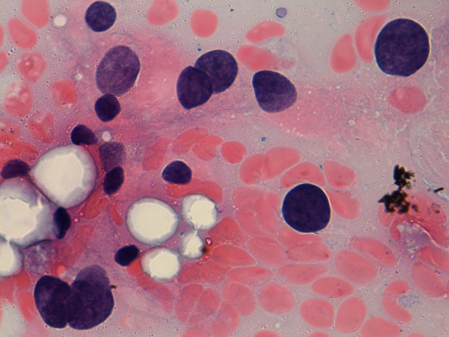 Right lobe, longitudinal scan