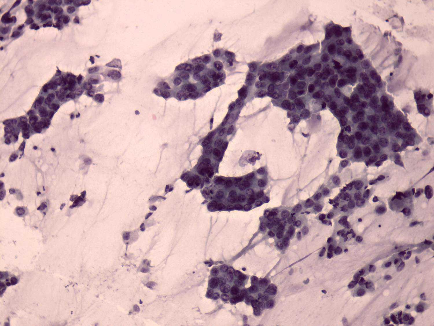 Right lobe, longitudinal scan