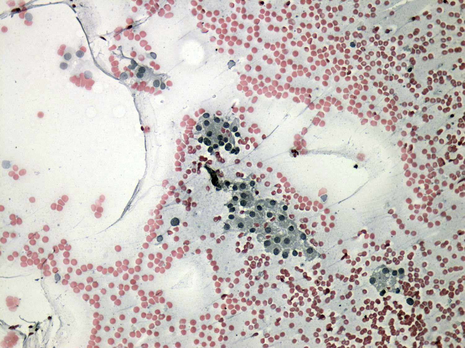 Right lobe, longitudinal scan