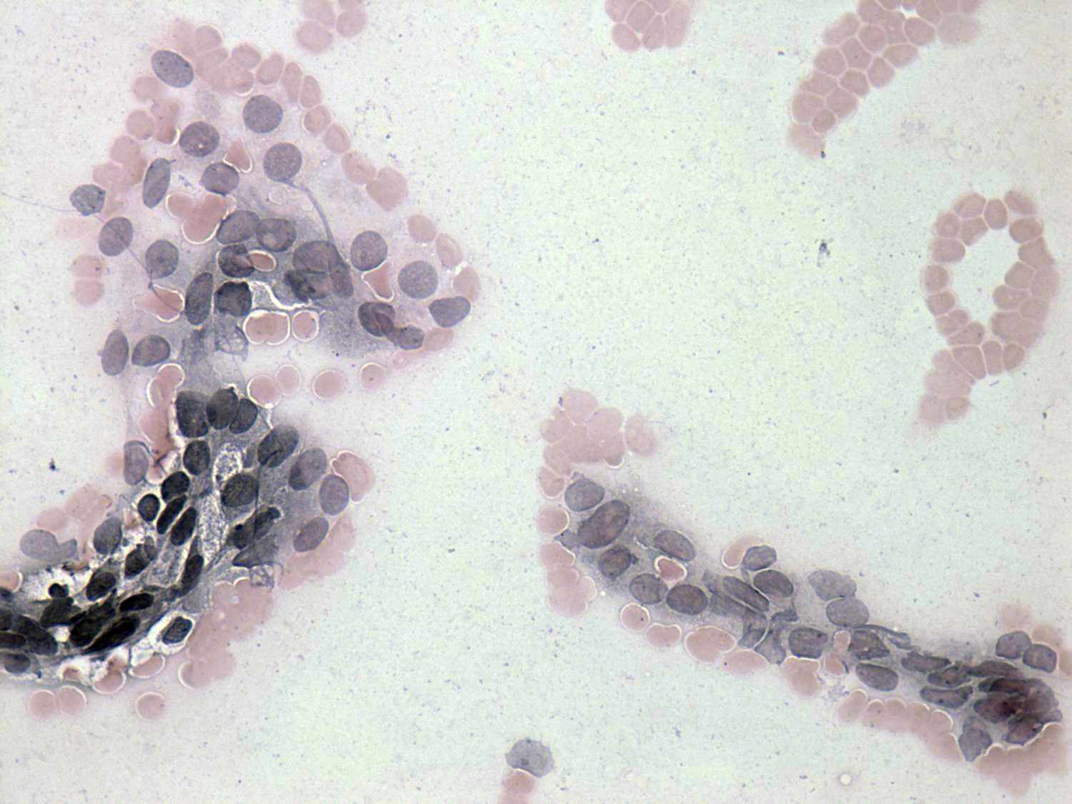 Right lobe, longitudinal scan
