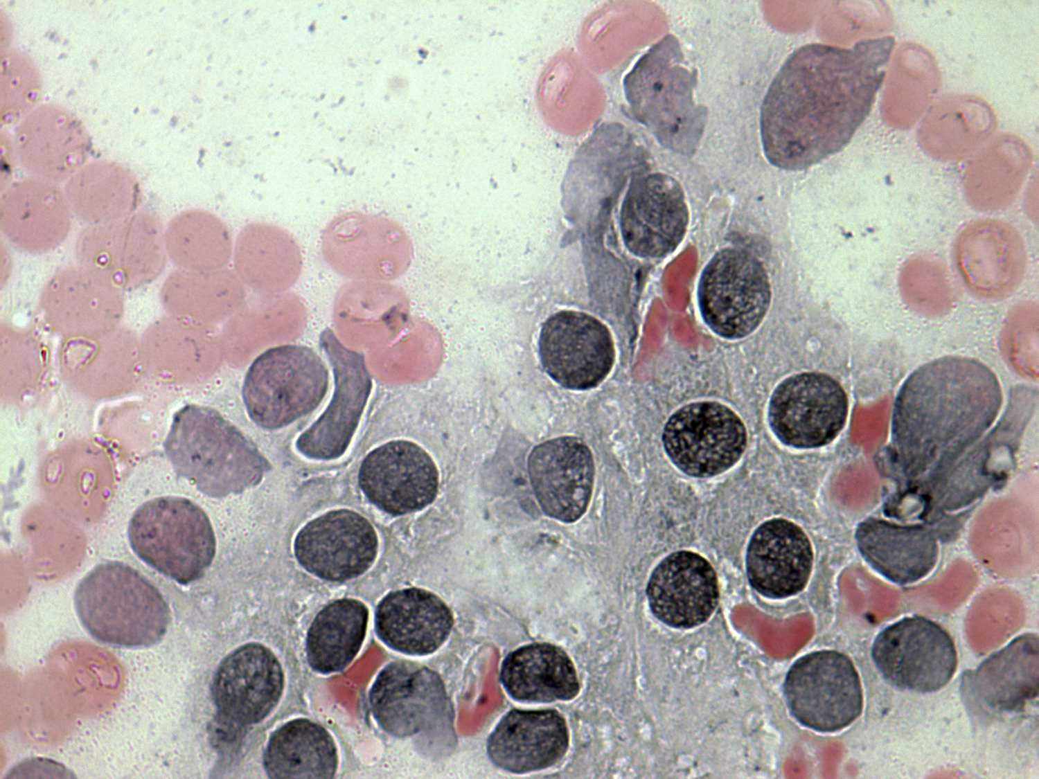 Right lobe, longitudinal scan