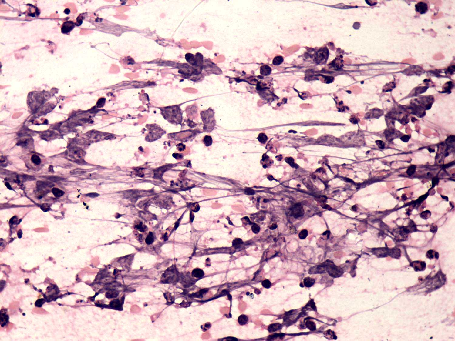 Right lobe, longitudinal scan