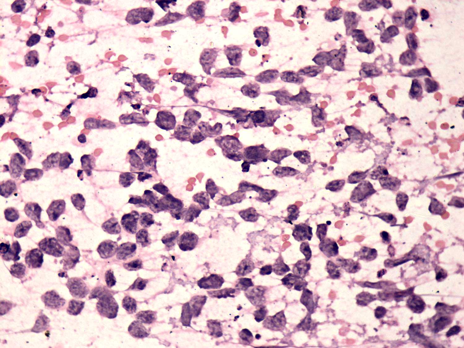 Right lobe, longitudinal scan