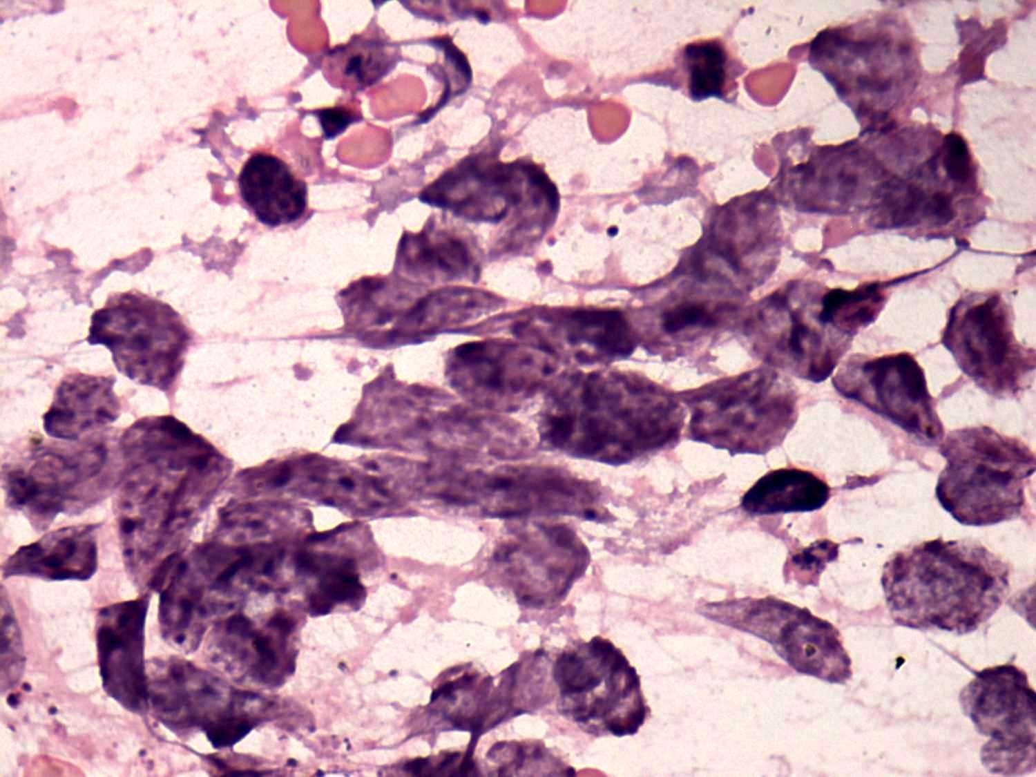 Right lobe, longitudinal scan