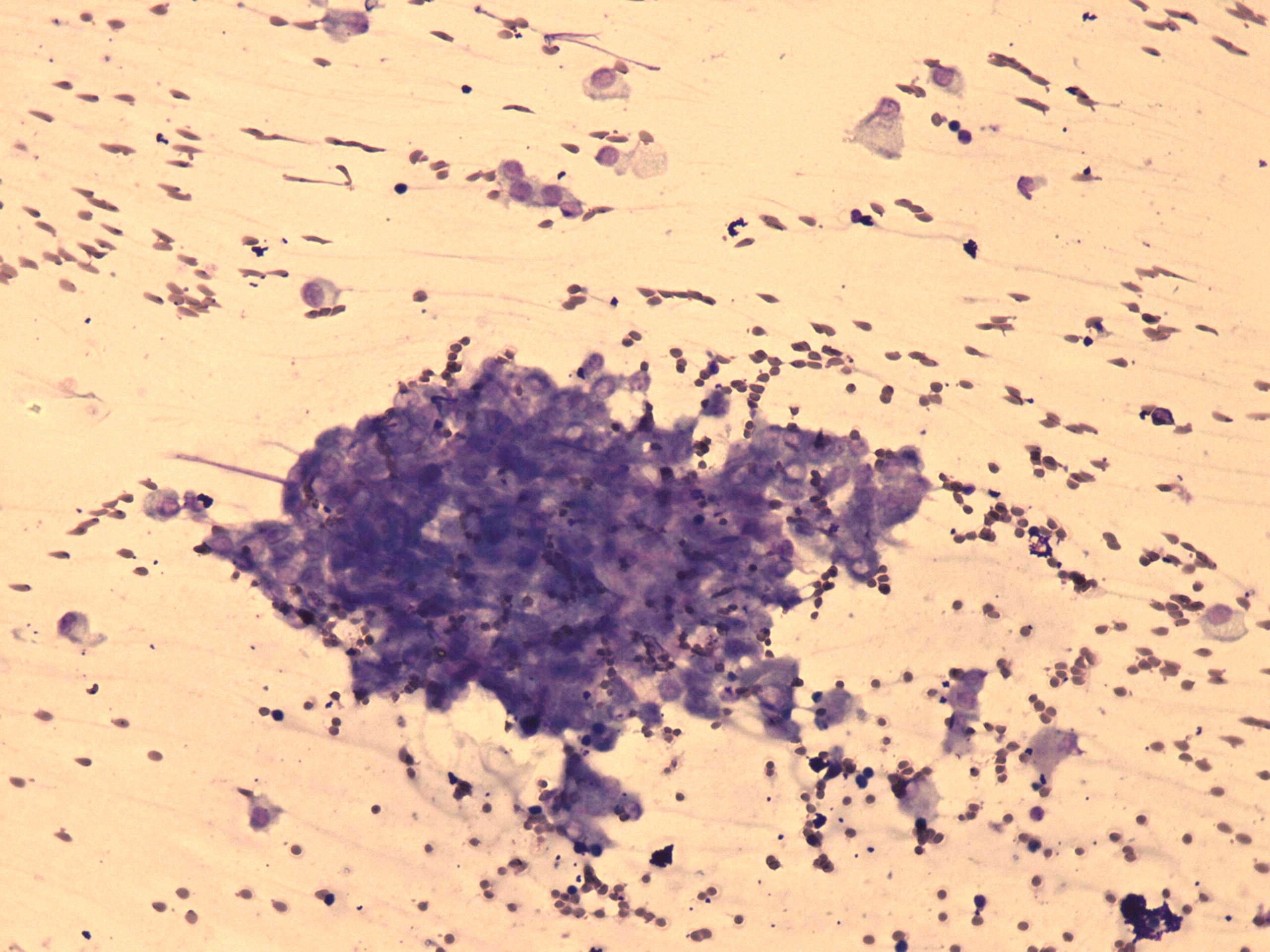 Right lobe, longitudinal scan