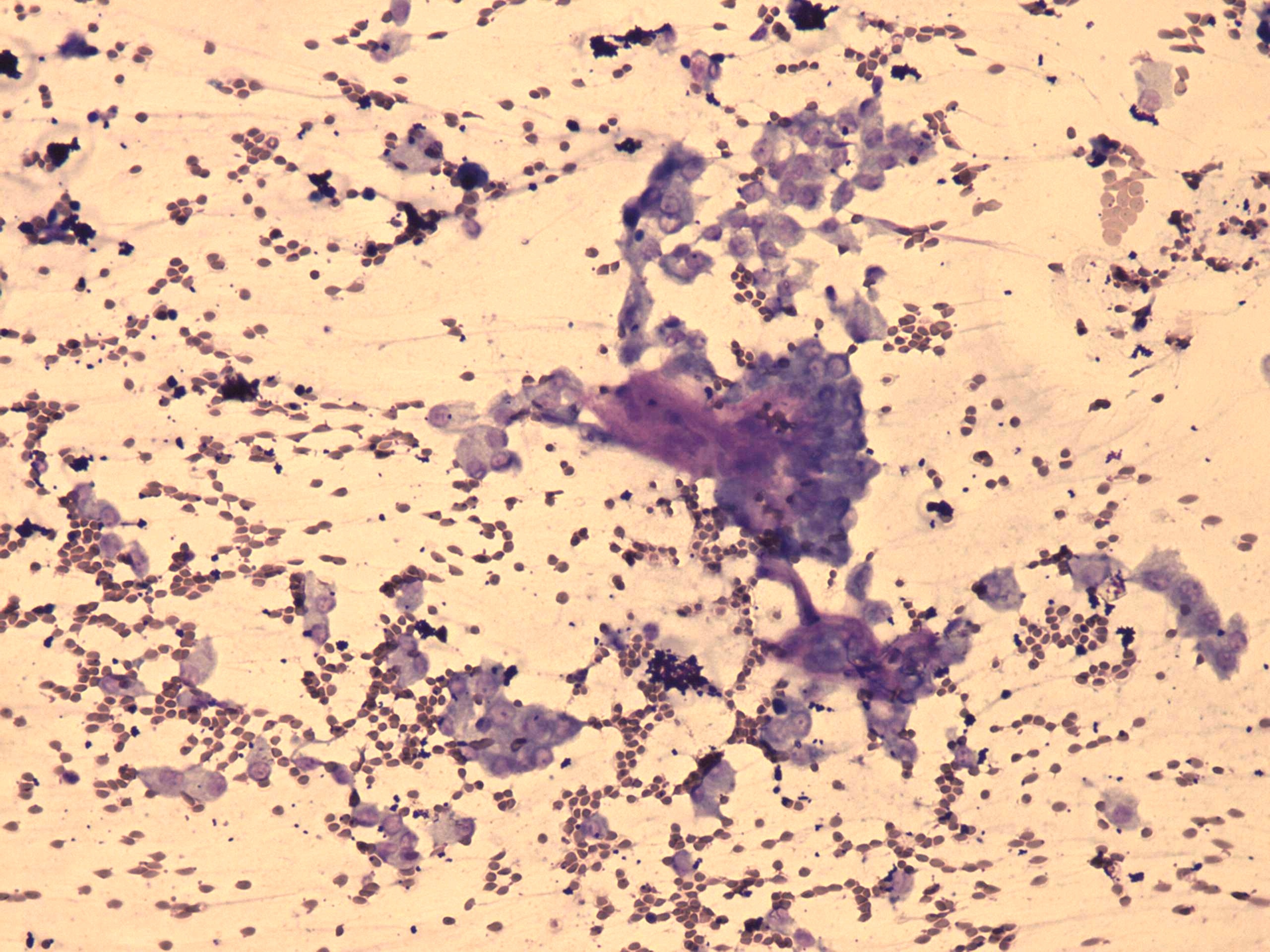Right lobe, longitudinal scan