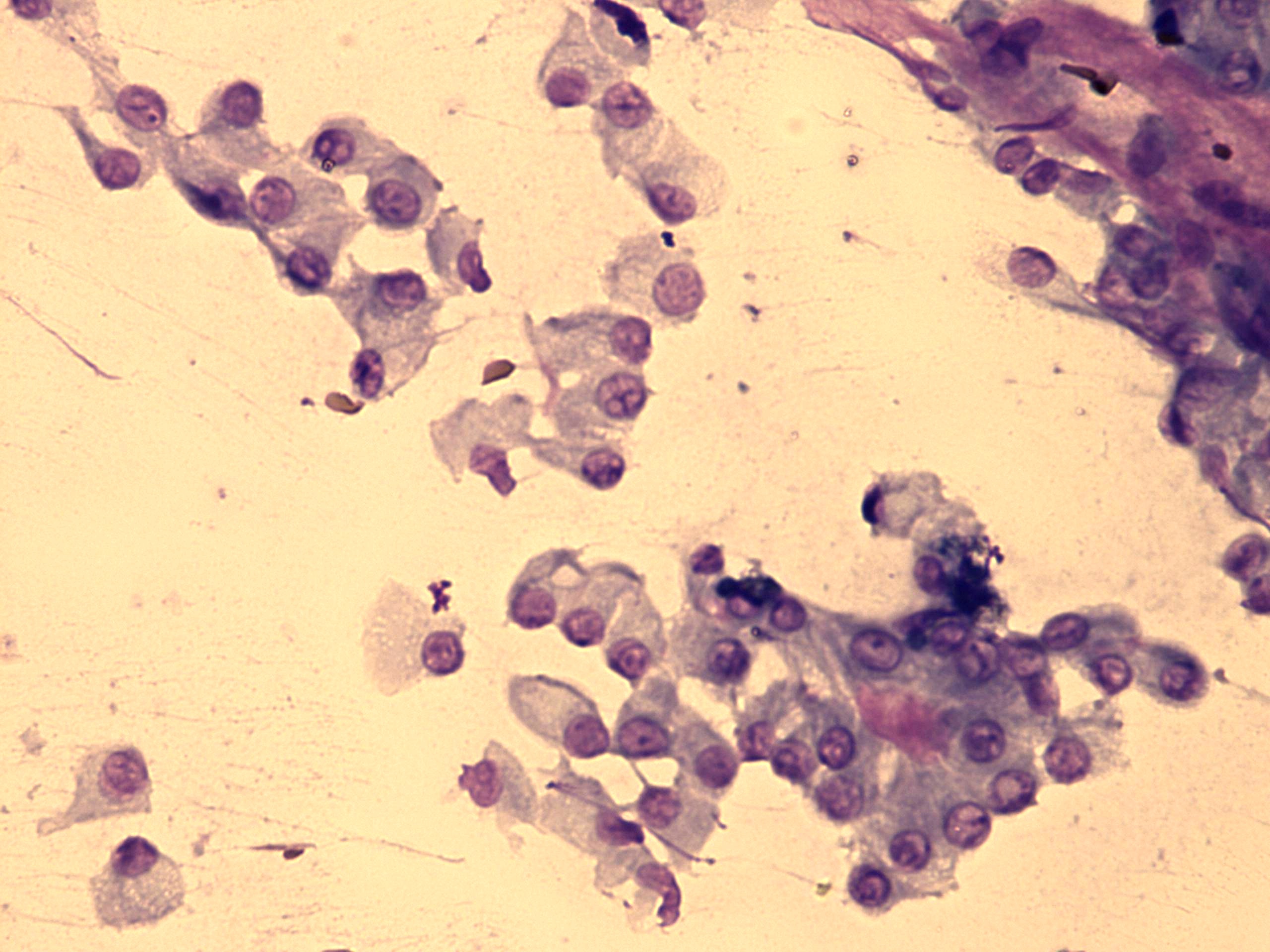 Right lobe, longitudinal scan