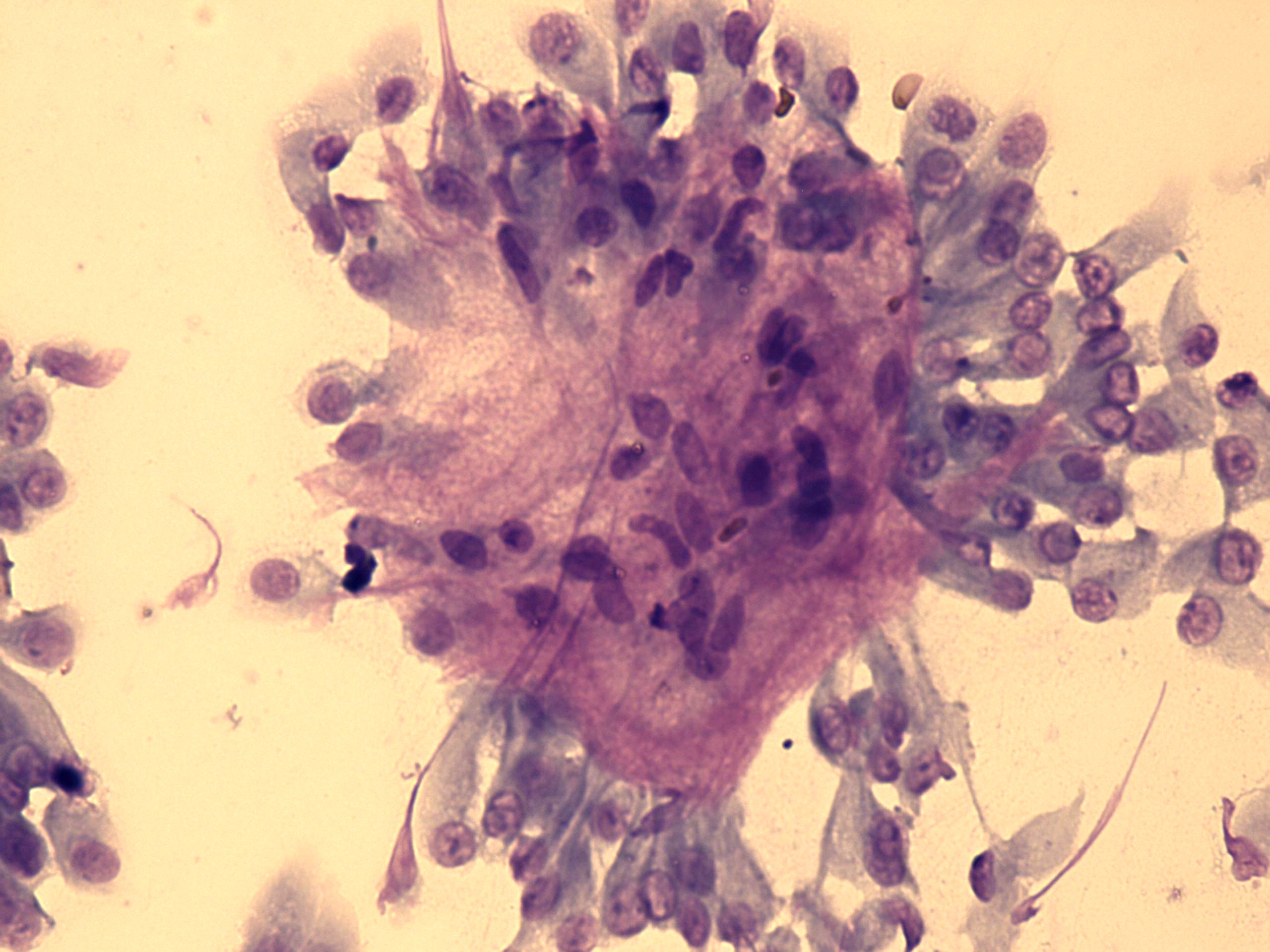 Right lobe, longitudinal scan