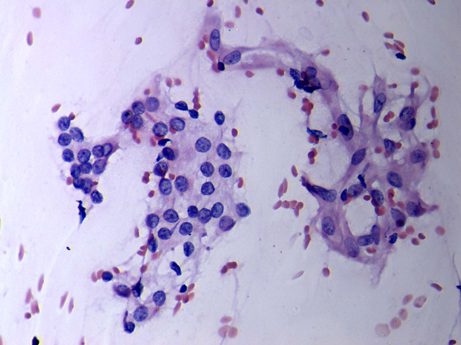 Right lobe, longitudinal scan